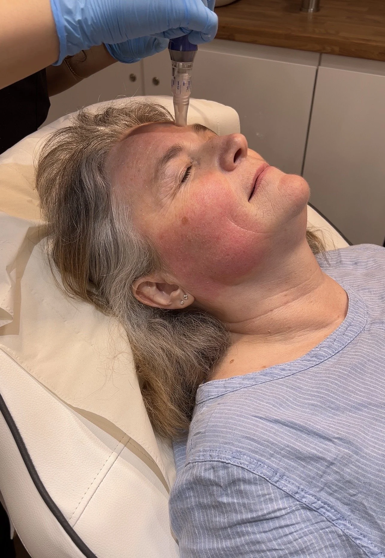 A woman receiving a facial treatment, lying down with eyes closed, as a skincare professional uses a black handheld device on her cheek.