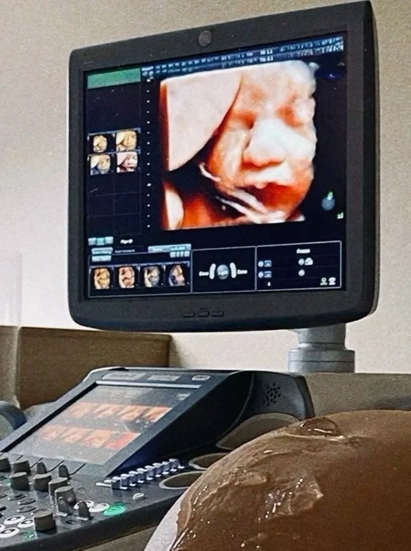 2D Reassurance / Well-Being Scan (14 - 42 weeks) £60.00