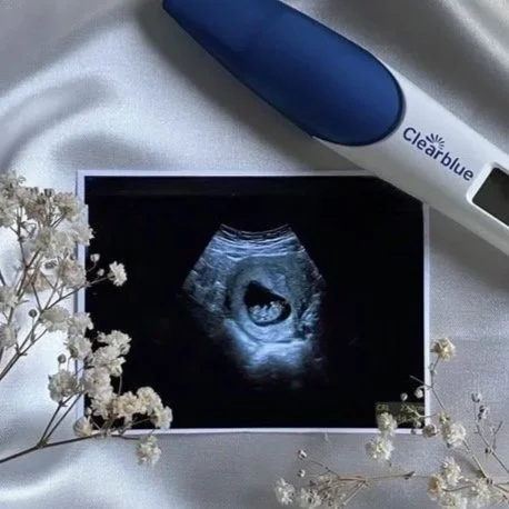 Early Reassurance Scan (6-13 weeks) £65.00