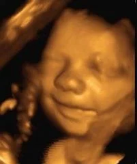 3D / 4D Well-Being Scan (22-35 weeks) £95.00