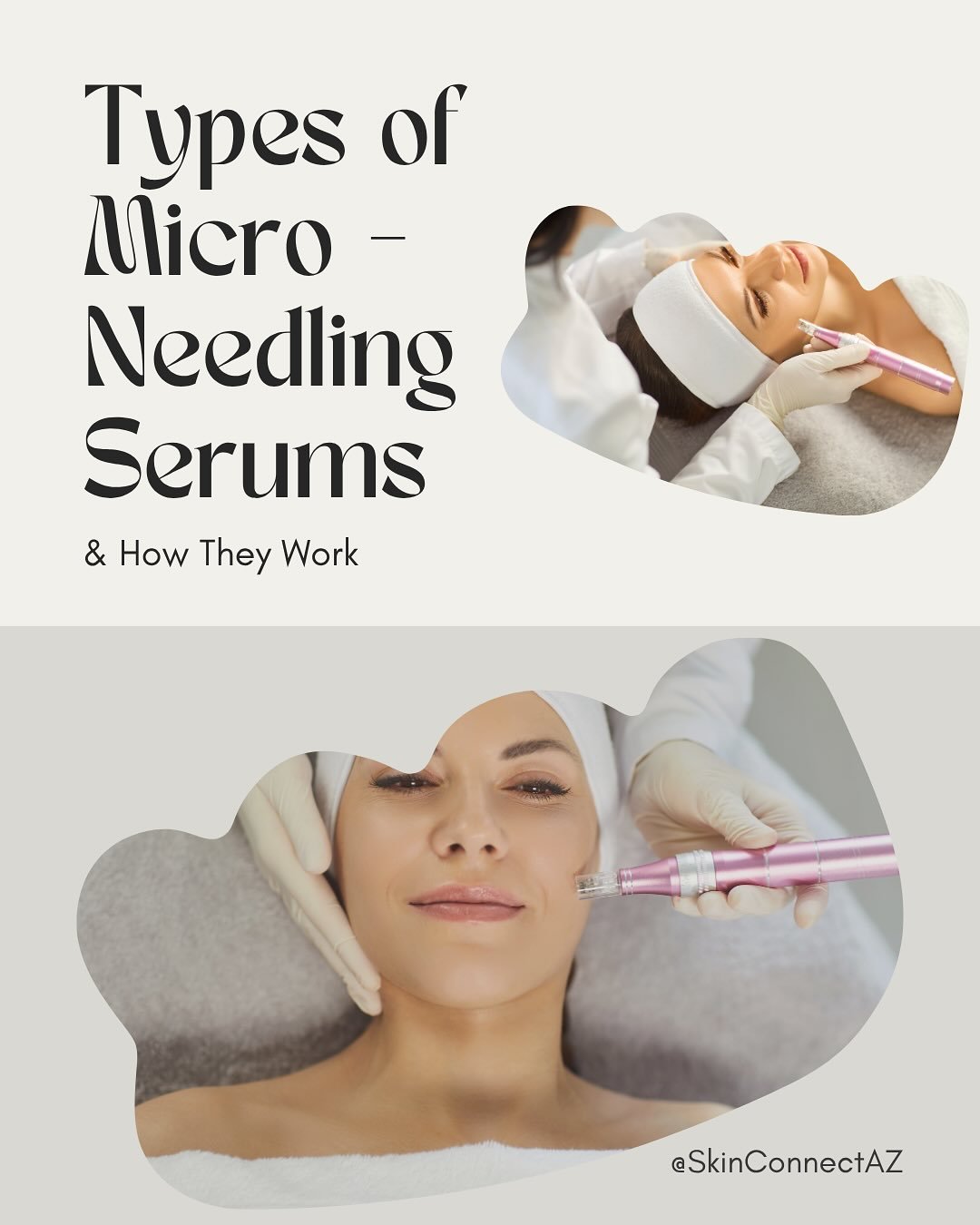 ✨ Ready to Glow for the Holidays? ✨

The secret to smooth, radiant, camera-ready skin starts now! Microneedling boosts collagen, refines texture, and enhances glow &mdash; and the best part? You&rsquo;ll see your most luminous results in about 4 week