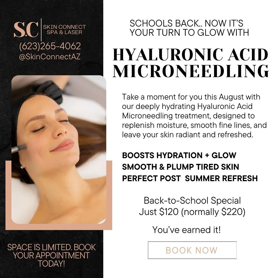 ✨Back-to-School Glow-Up Starts Here!✨
Moms, it&rsquo;s your turn to shine! 💧 Rehydrate, plump, and refresh your skin with our Hyaluronic Acid Microneedling treatment &mdash; now only $120 (normally $220) for the month of August.
📍Skin Connect Spa &
