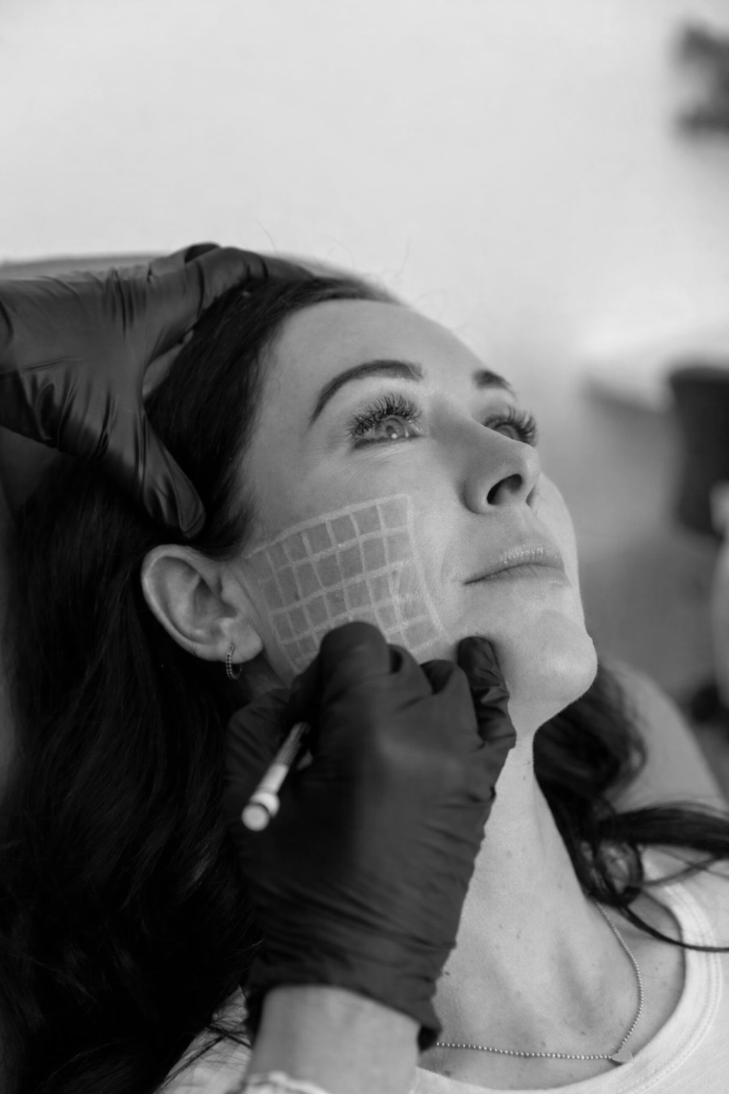 A woman lying down with medical adhesive grid on her cheek, having a cosmetic procedure done by a professional with gloved hands.