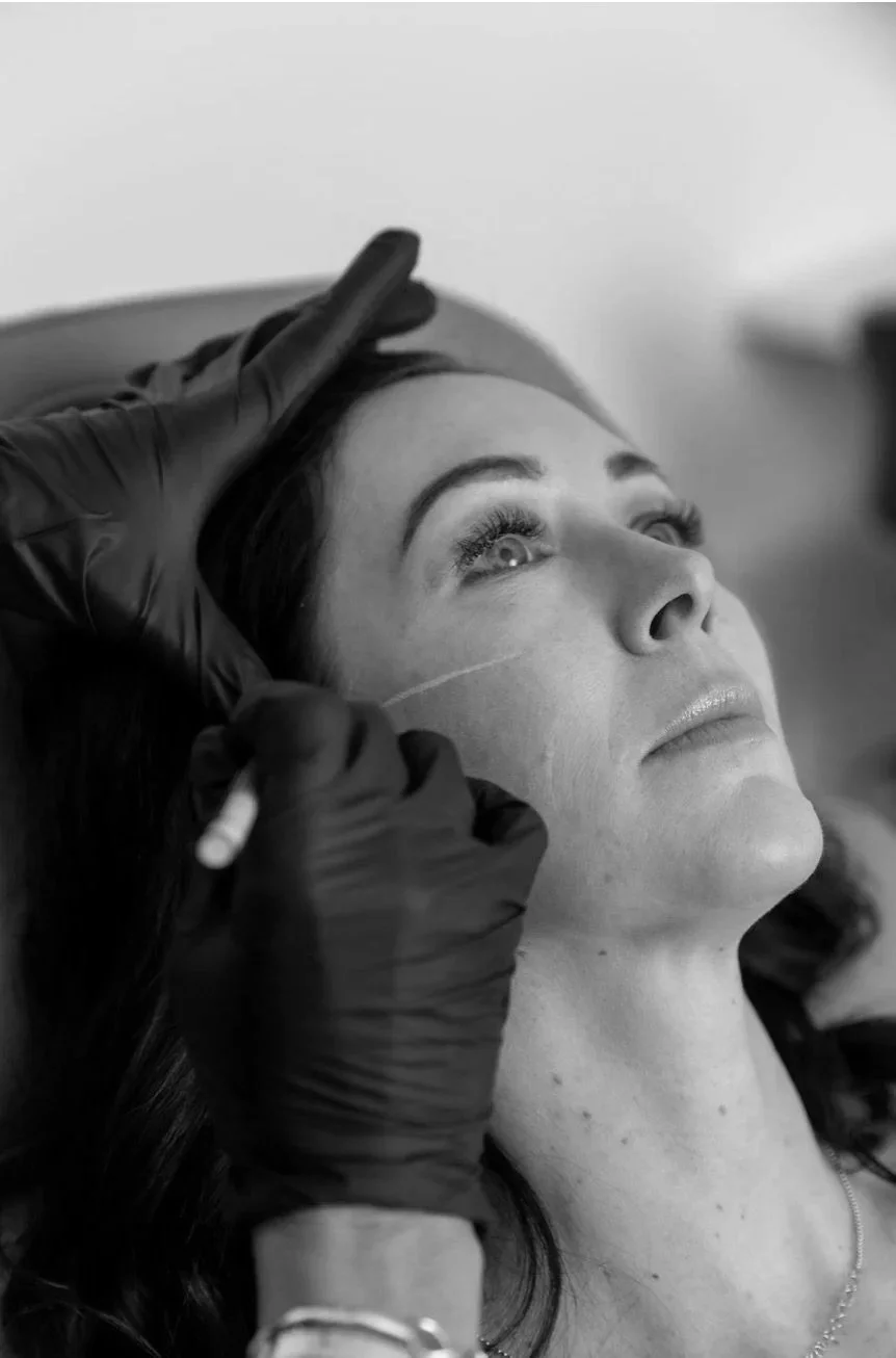 A woman is receiving a beauty or cosmetic treatment, lying down with her eyes open. A person wearing black gloves is applying a procedure near her forehead.