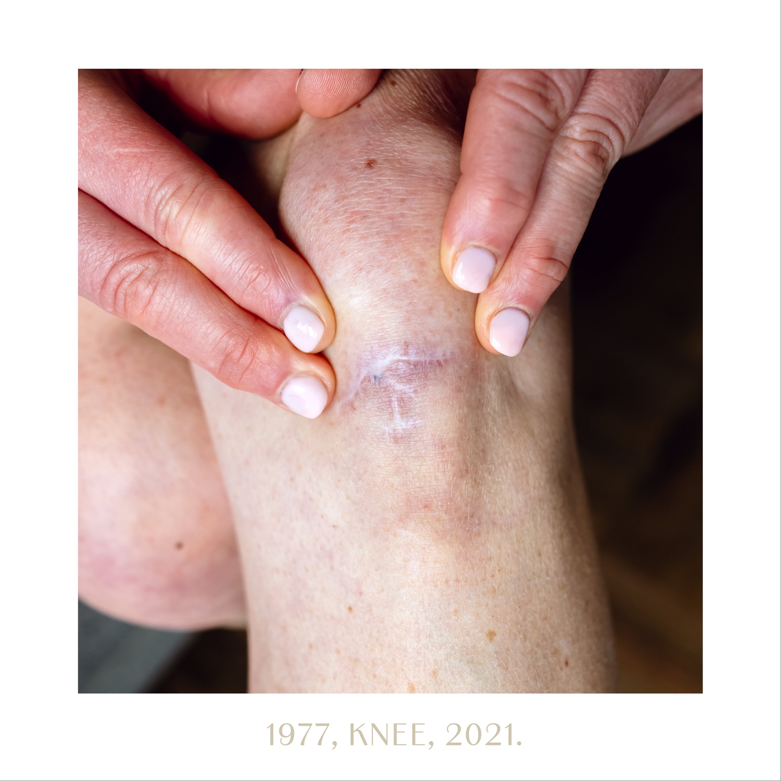 1977, knee, 2021.jpg