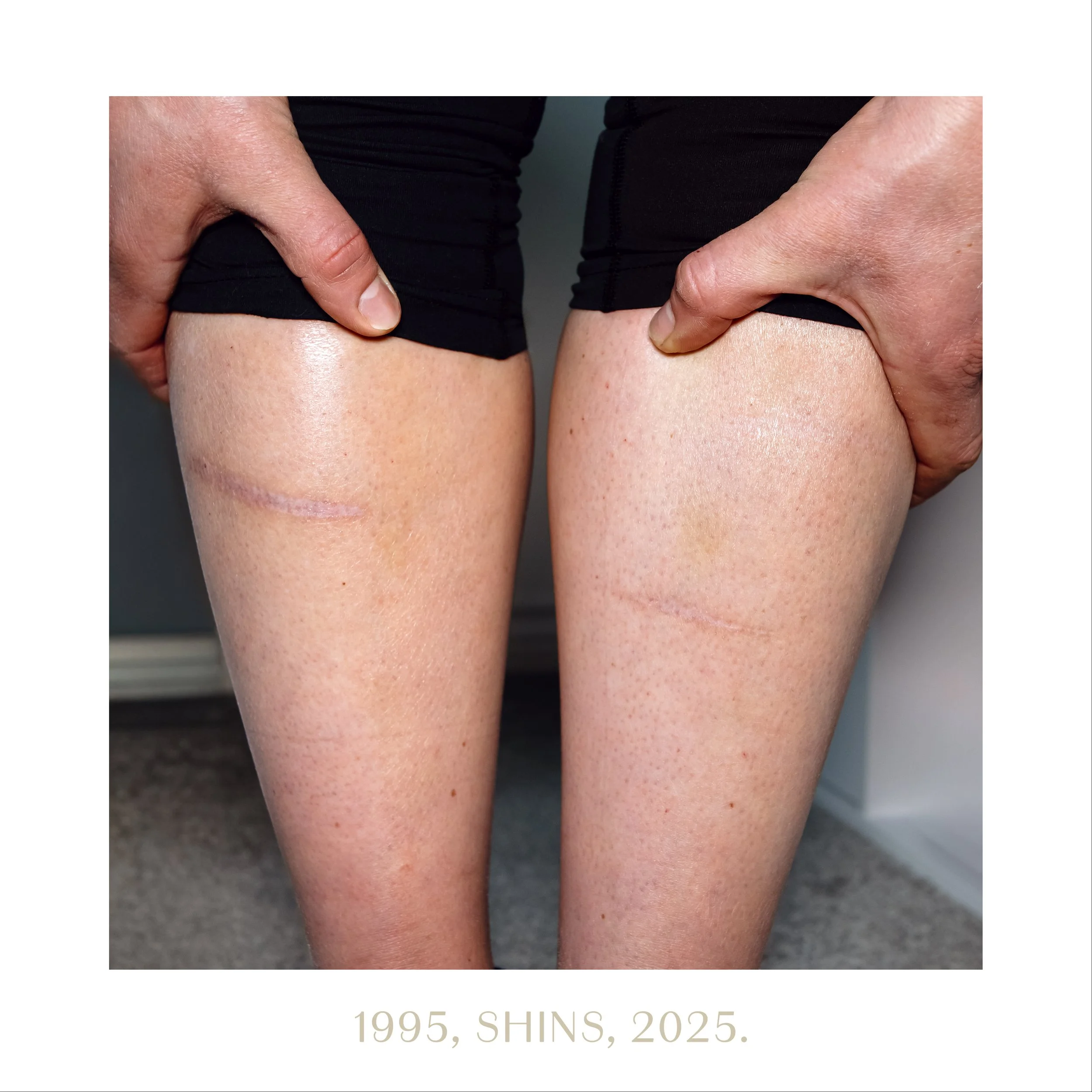 1995, shins, 2025.jpg