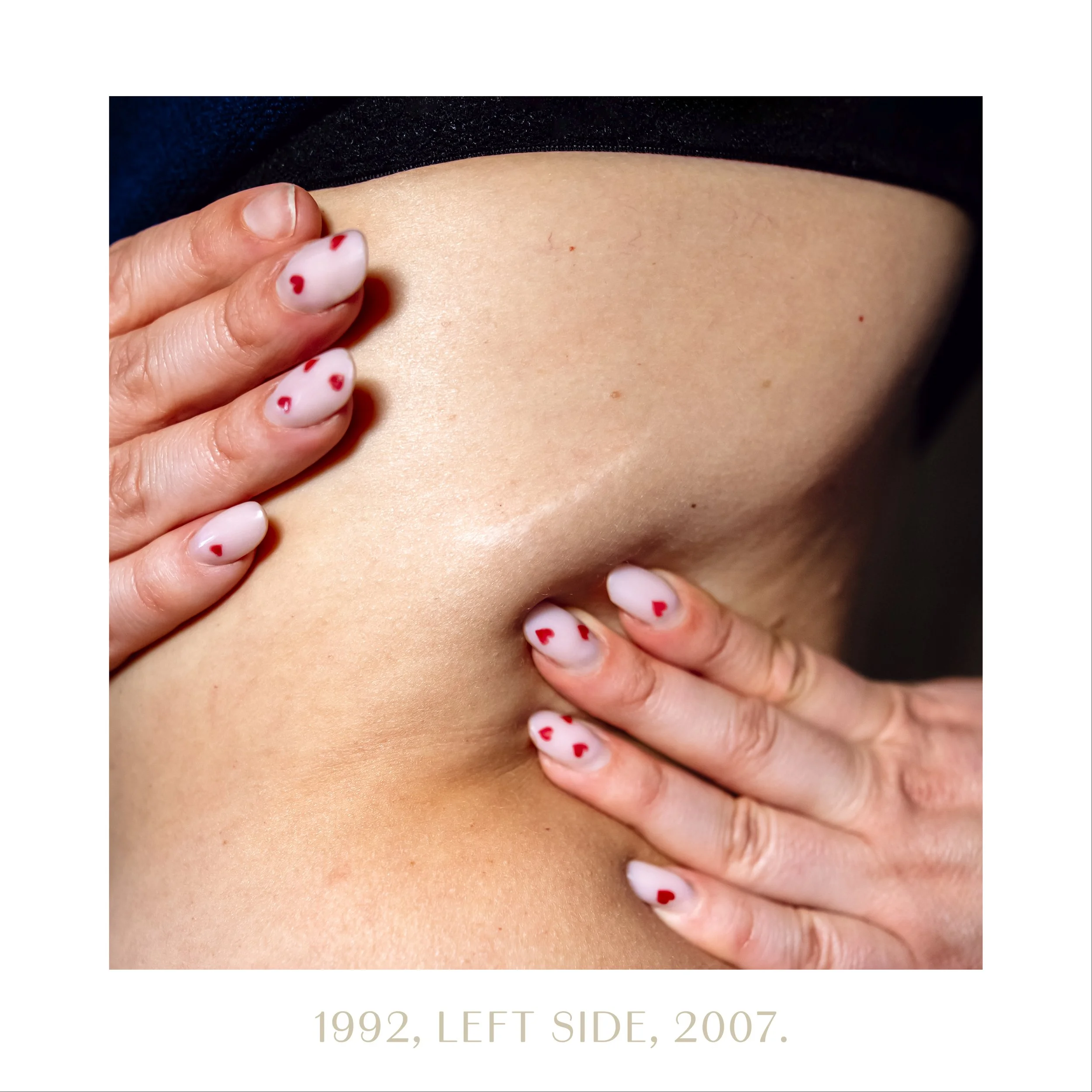 1992, left side, 2007.jpg
