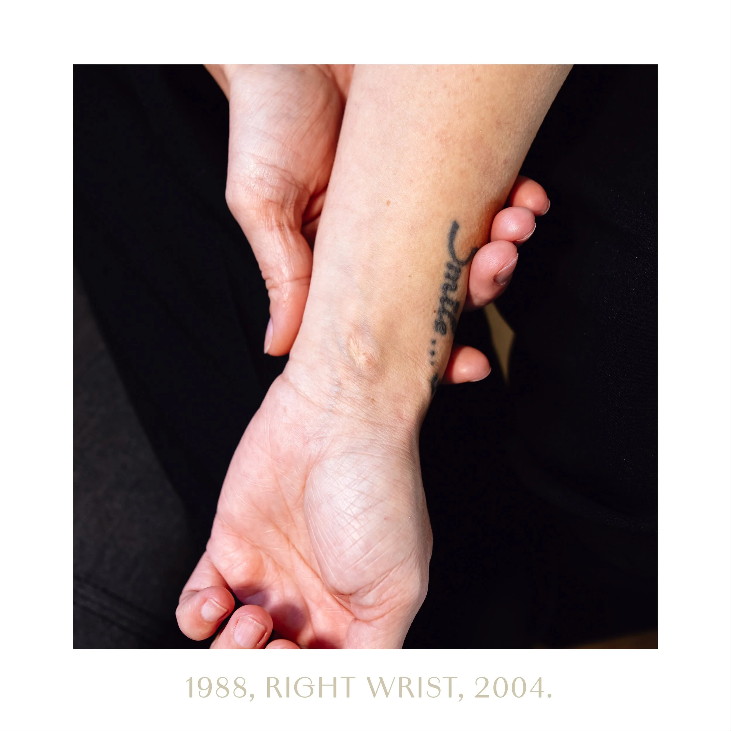 1988, right wrist, 2004.jpg