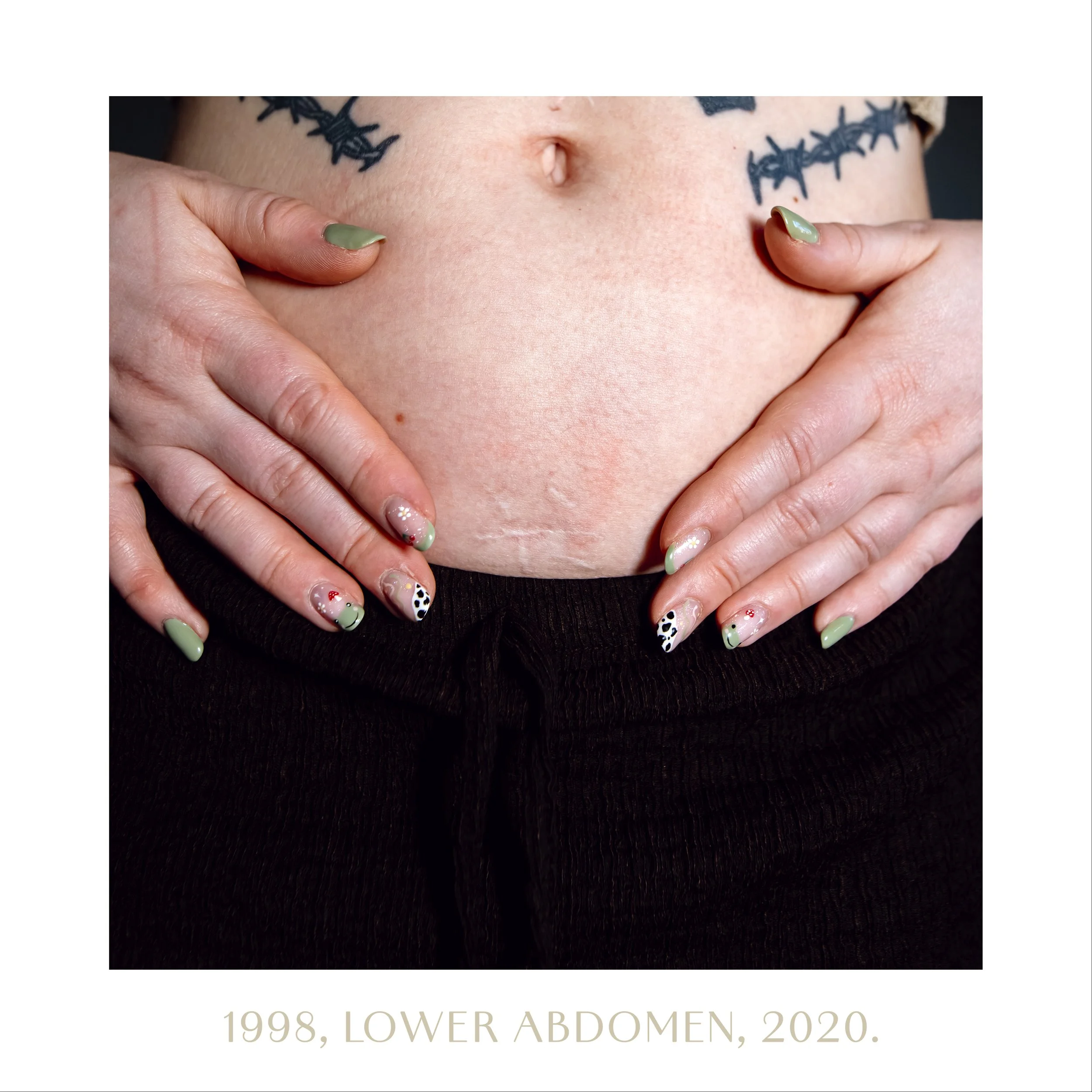 1998, lower abdomen, 2020.jpg