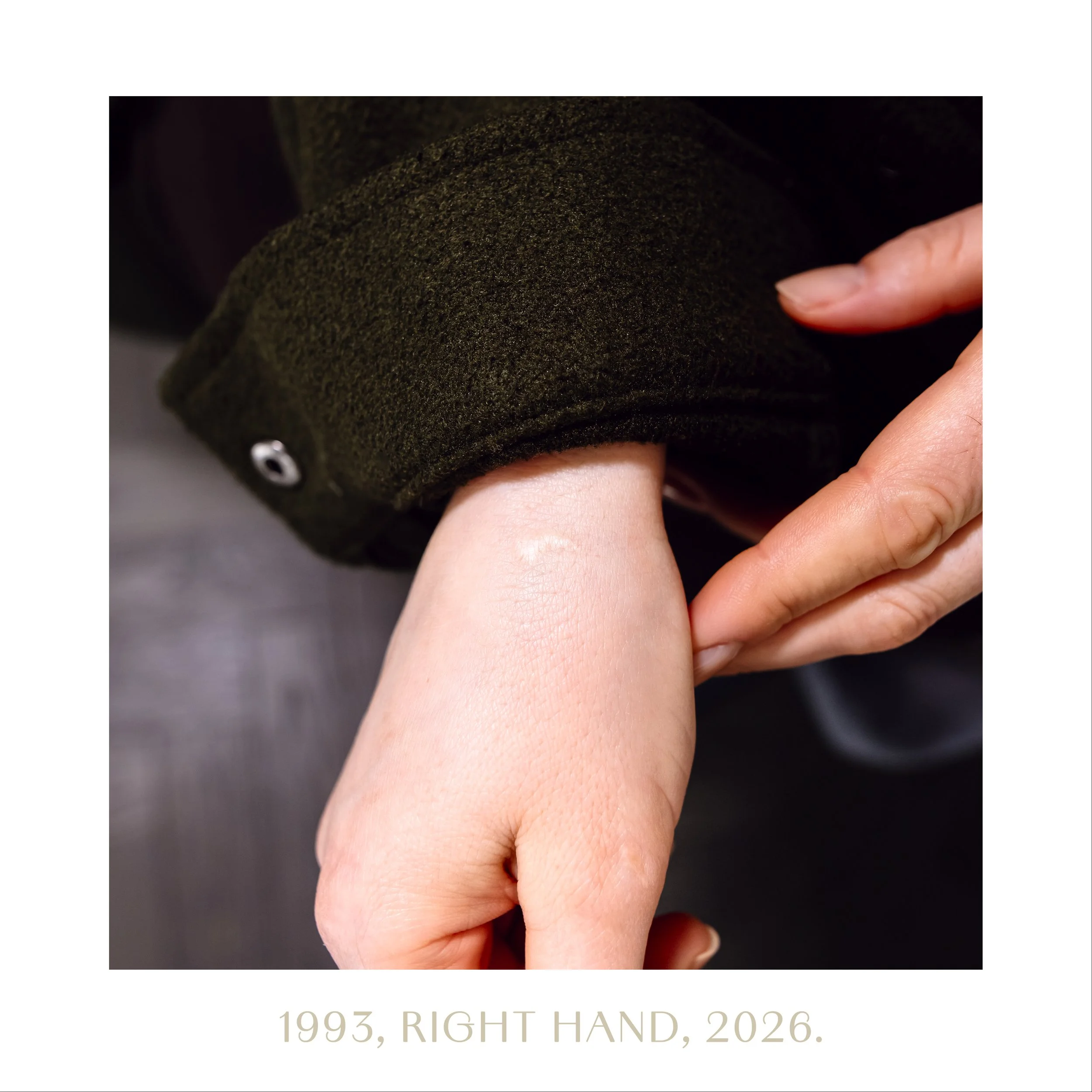 1993, right hand, 2026.jpg