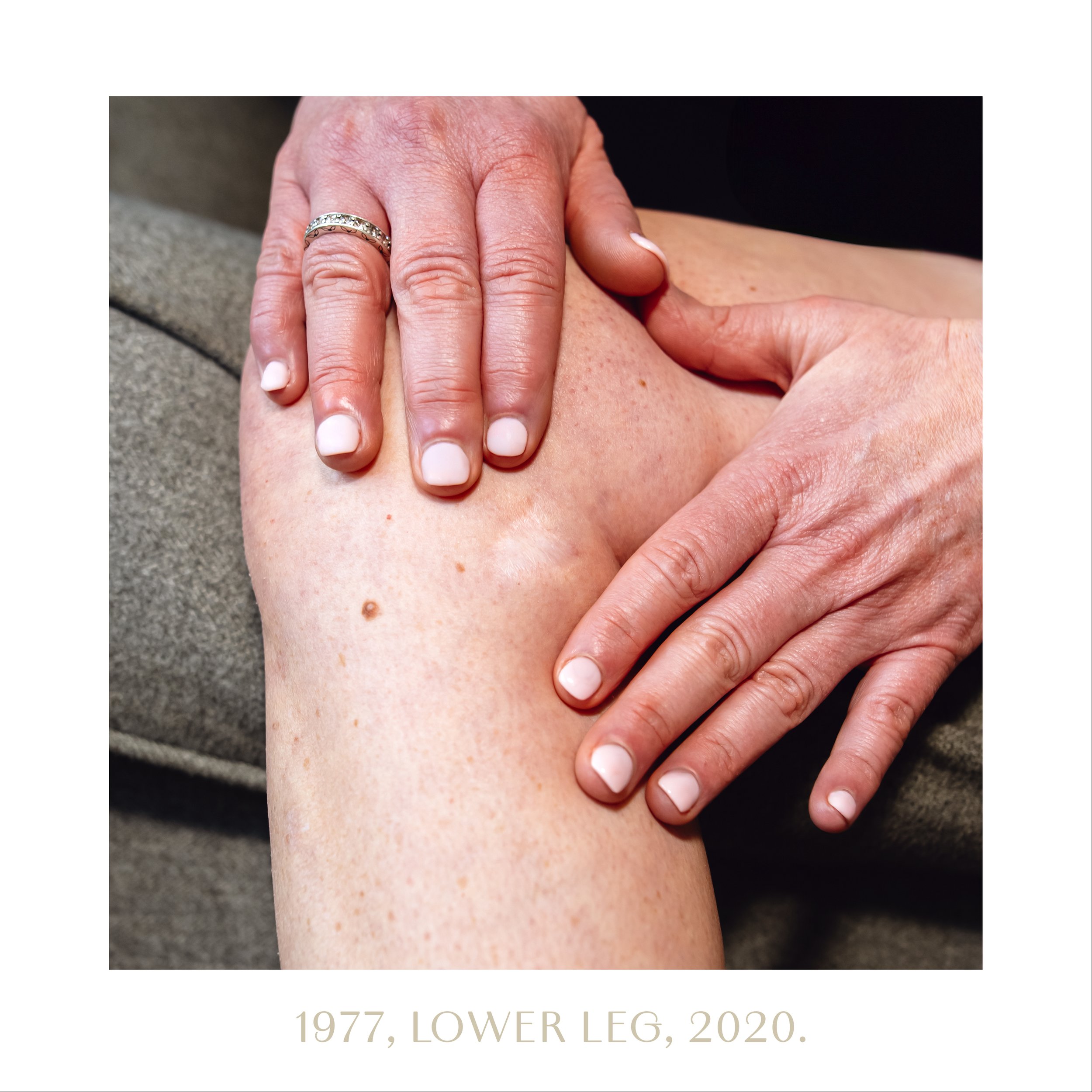 1977, lower leg, 2020.jpg