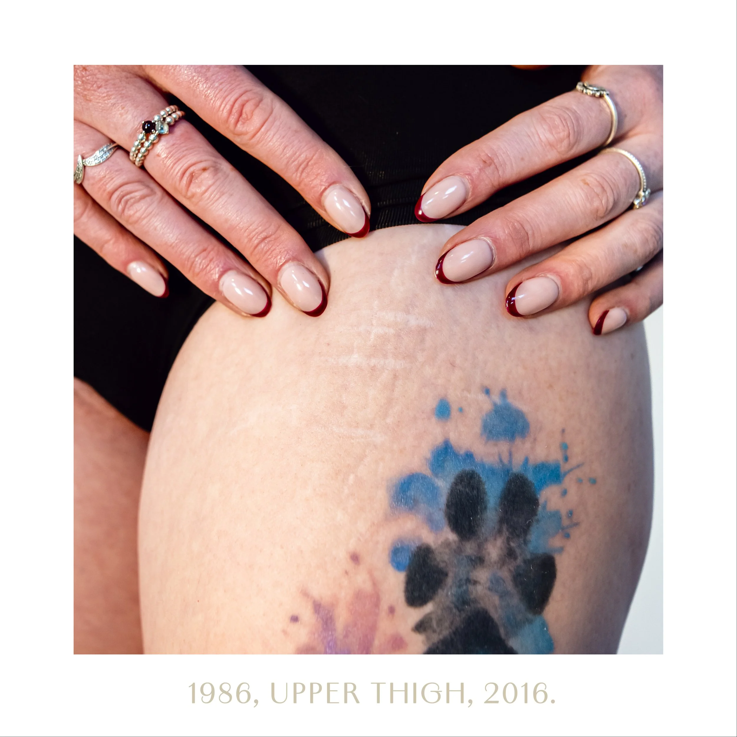 1986, upper thigh, 2016.jpg