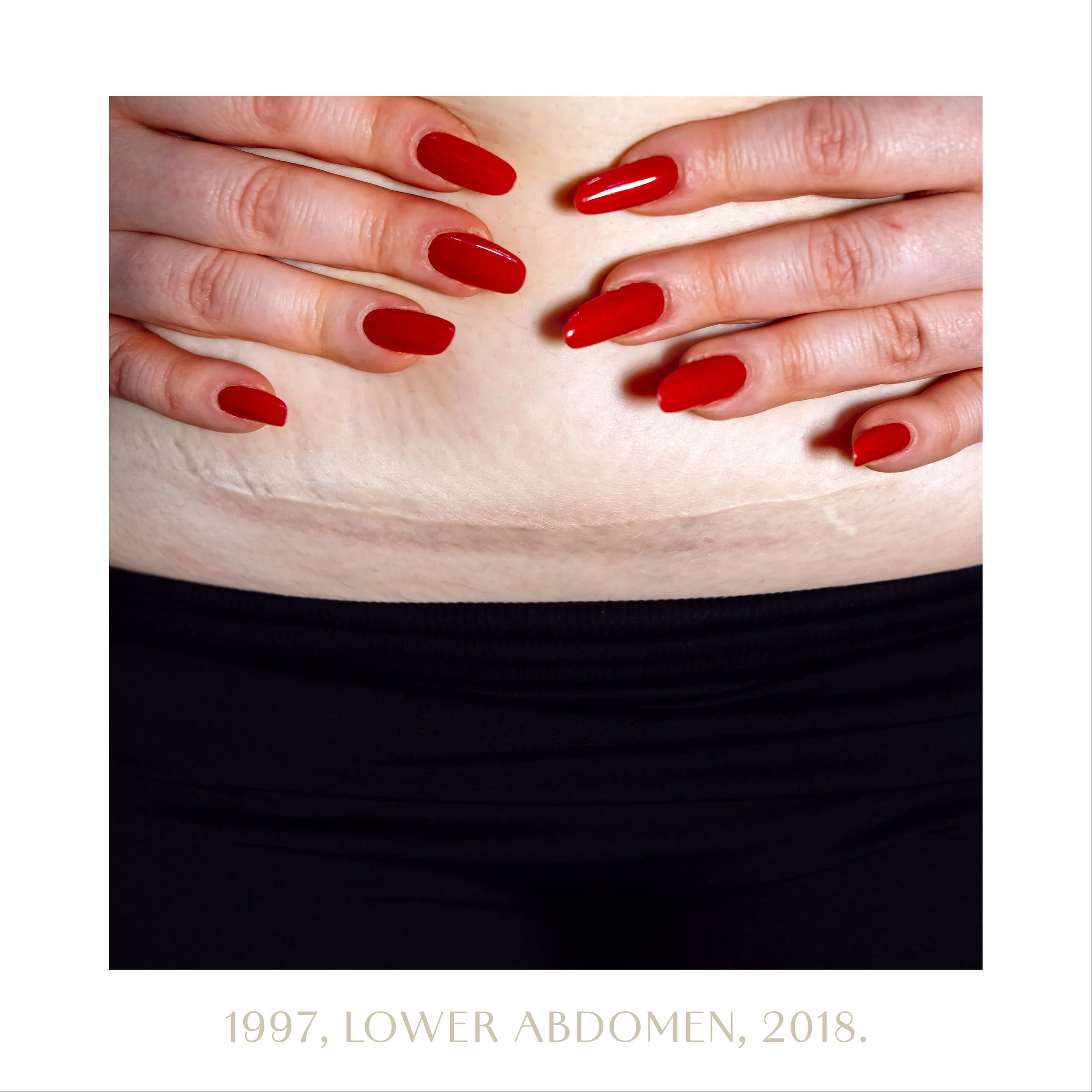 1997, lower abdomen, 2018.jpg