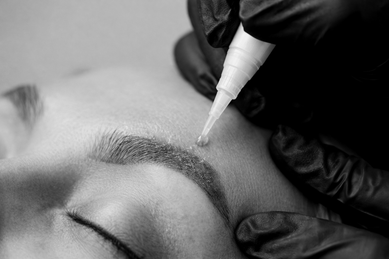 A person receiving a cosmetic or medical injection near their eyebrow, with a gloved hand holding a syringe.