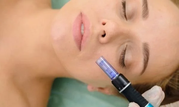Microneedling + PRP
Enhanced regeneration using your body’s growth factors
$395.00