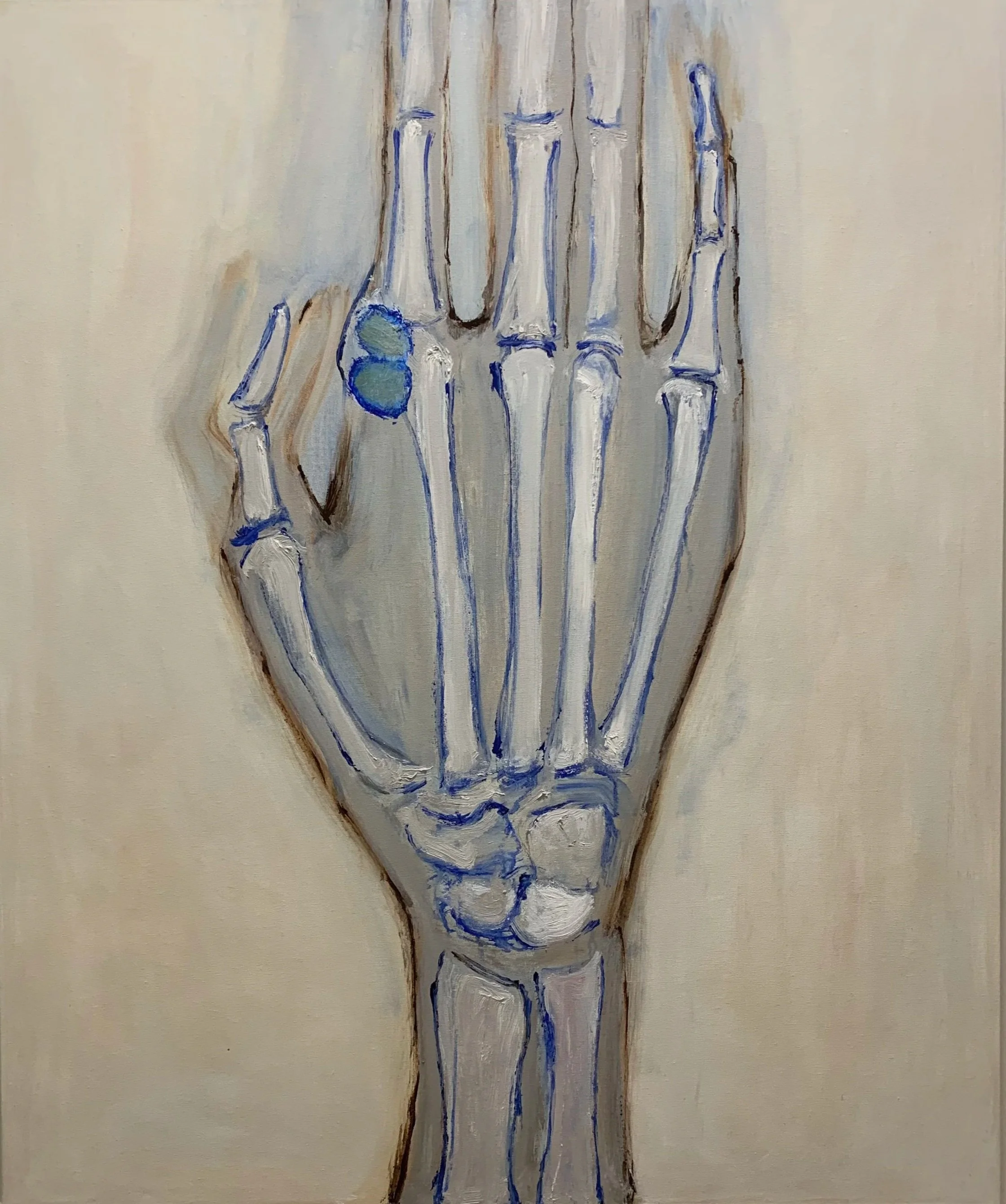 26