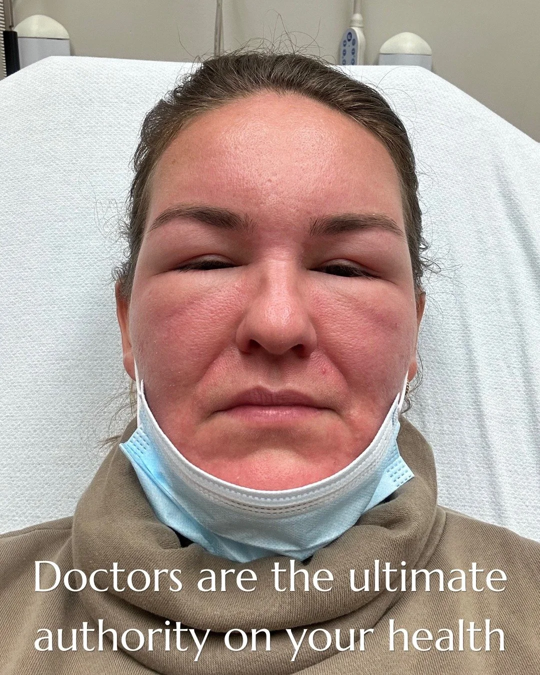 Doctors are the ultimate authority on your health. APRIL FOOLS! 

Nothing forces you to take your health seriously like an allergic reaction that makes you look like this 😂🤪😭

In the ER, they hit me with a massive dose of antihistamines and steroi