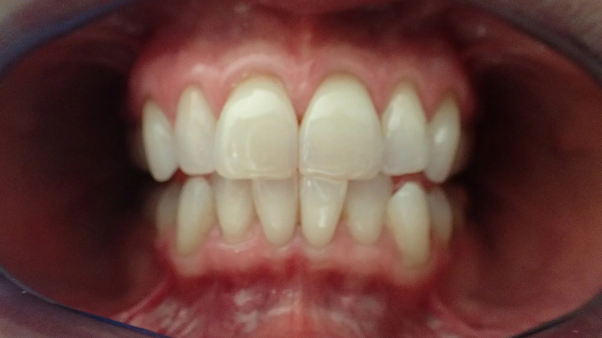 Closeup of teeth.