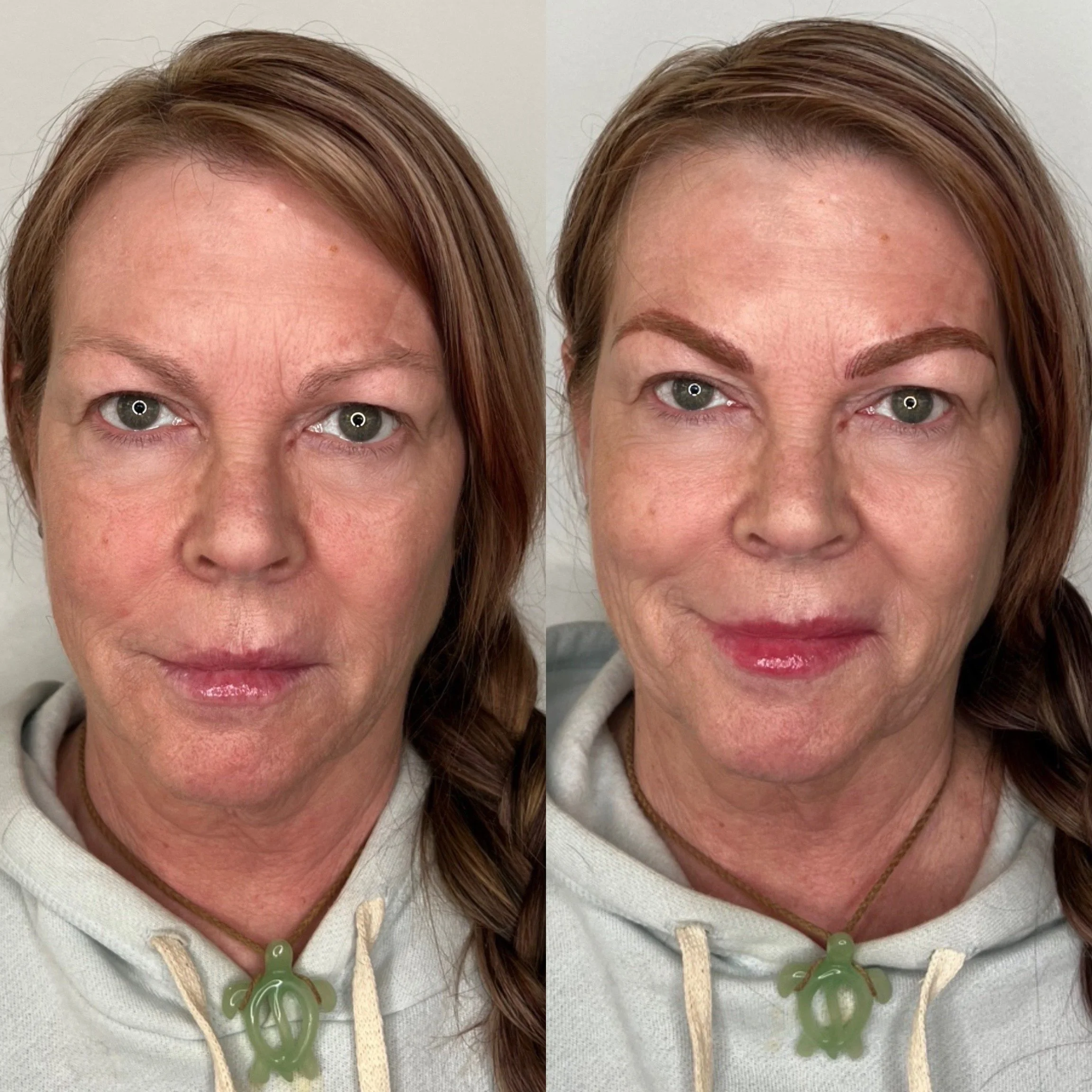 Before enhancement/After Combo 