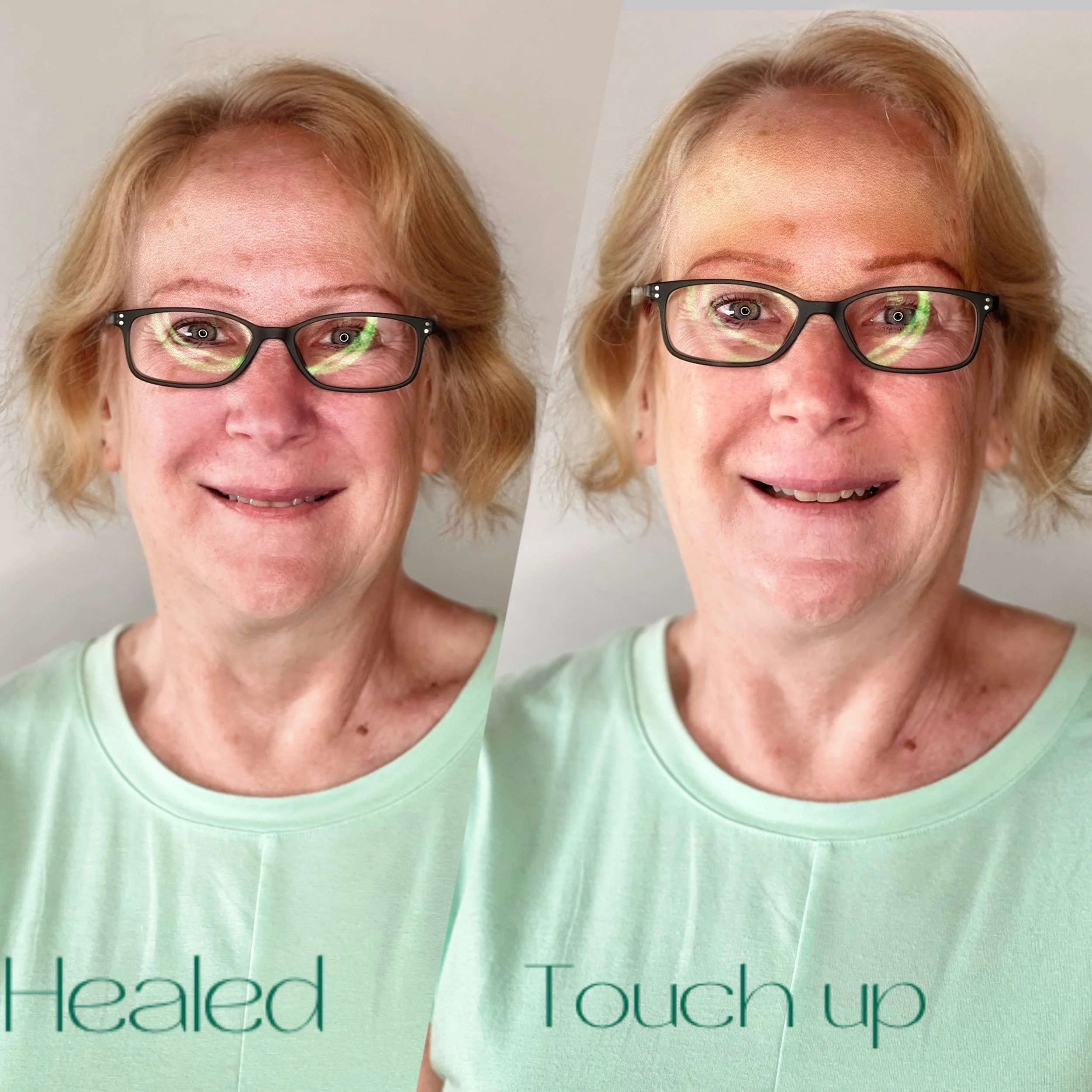 Healed/Touch Up Combo