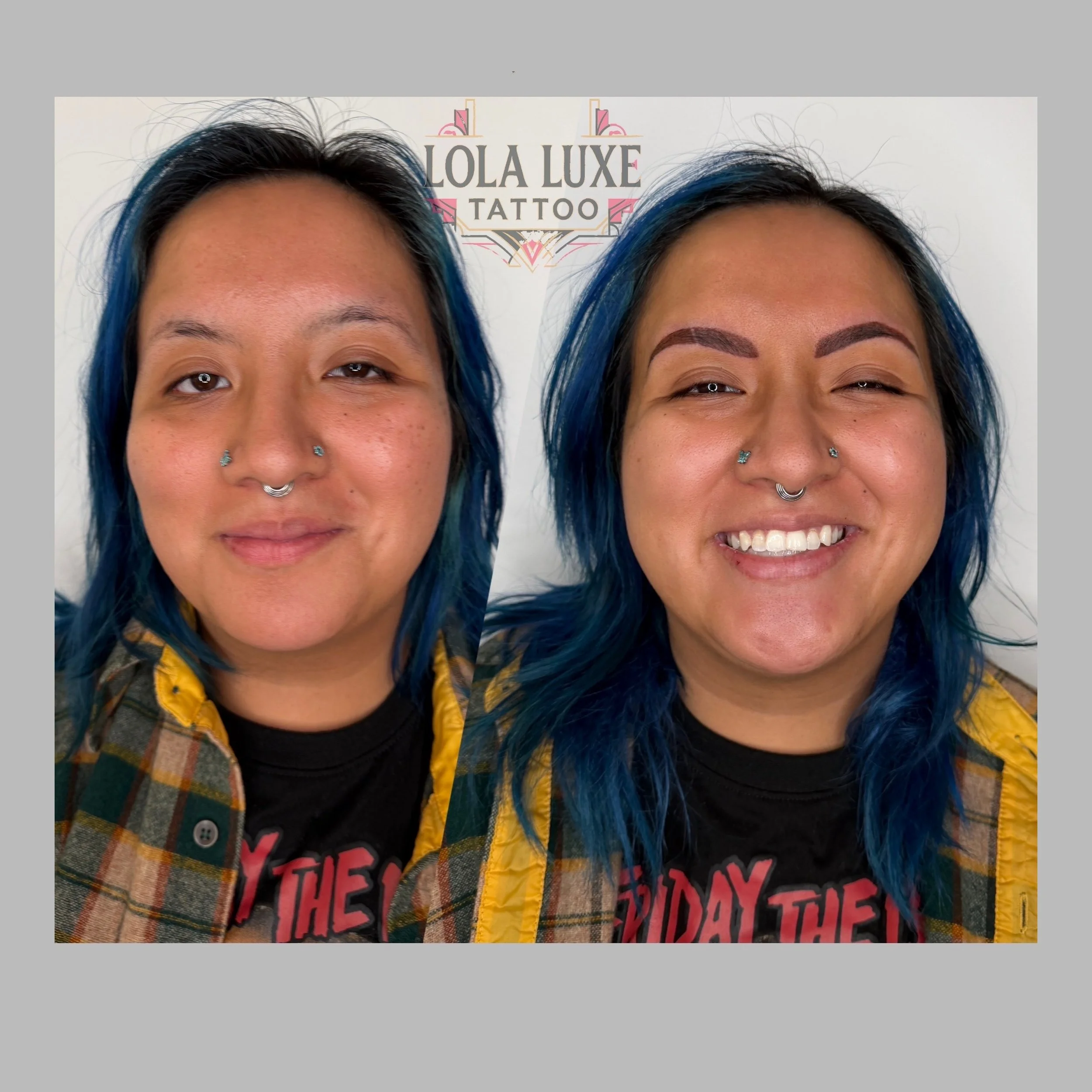 Side-by-side before and after photos of a woman with blue hair, showing her face with visible skin issues in the before photo and smooth, clear skin in the after photo, smiling in the after shot, at Lola Luxe Tattoo