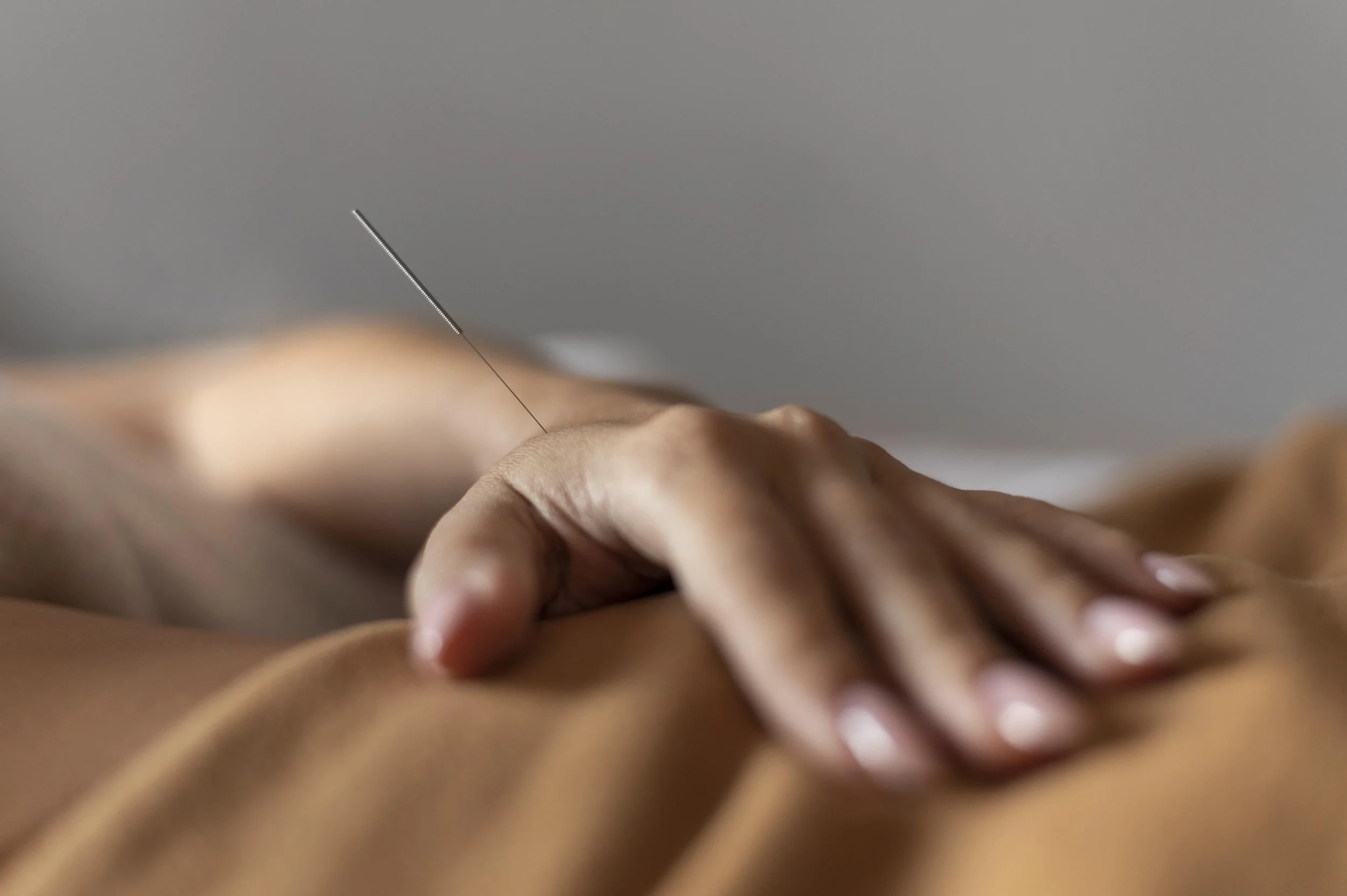 Close-up of a person receiving acupuncture treatment with a fine needle inserted into their skin.
