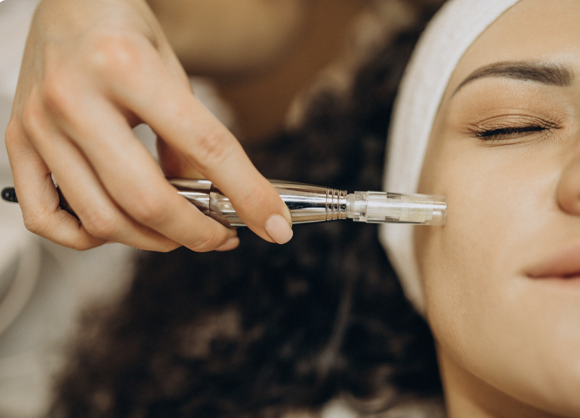A woman receives a facial treatment with a small dermal roller or microneedling device on her cheek, with her eyes closed and wearing a headband.