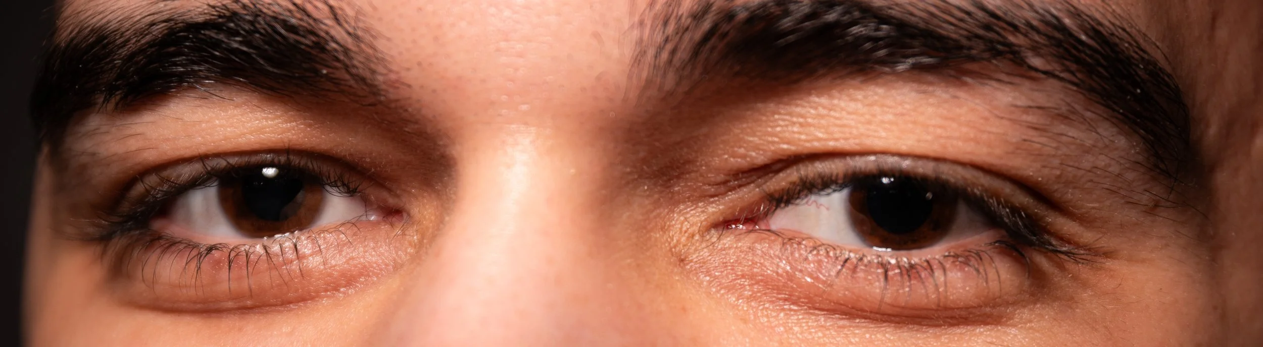 Nahaufnahme der Augen und Stirn einer Person mit braunen Augen und dunklen Haaren.