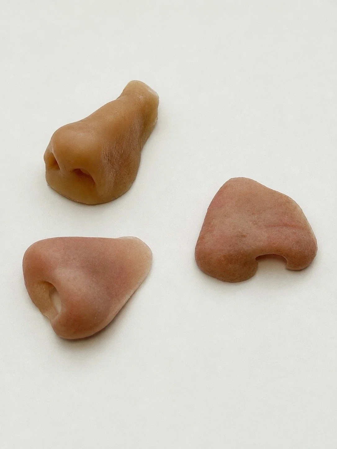 Nasal Prosthesis