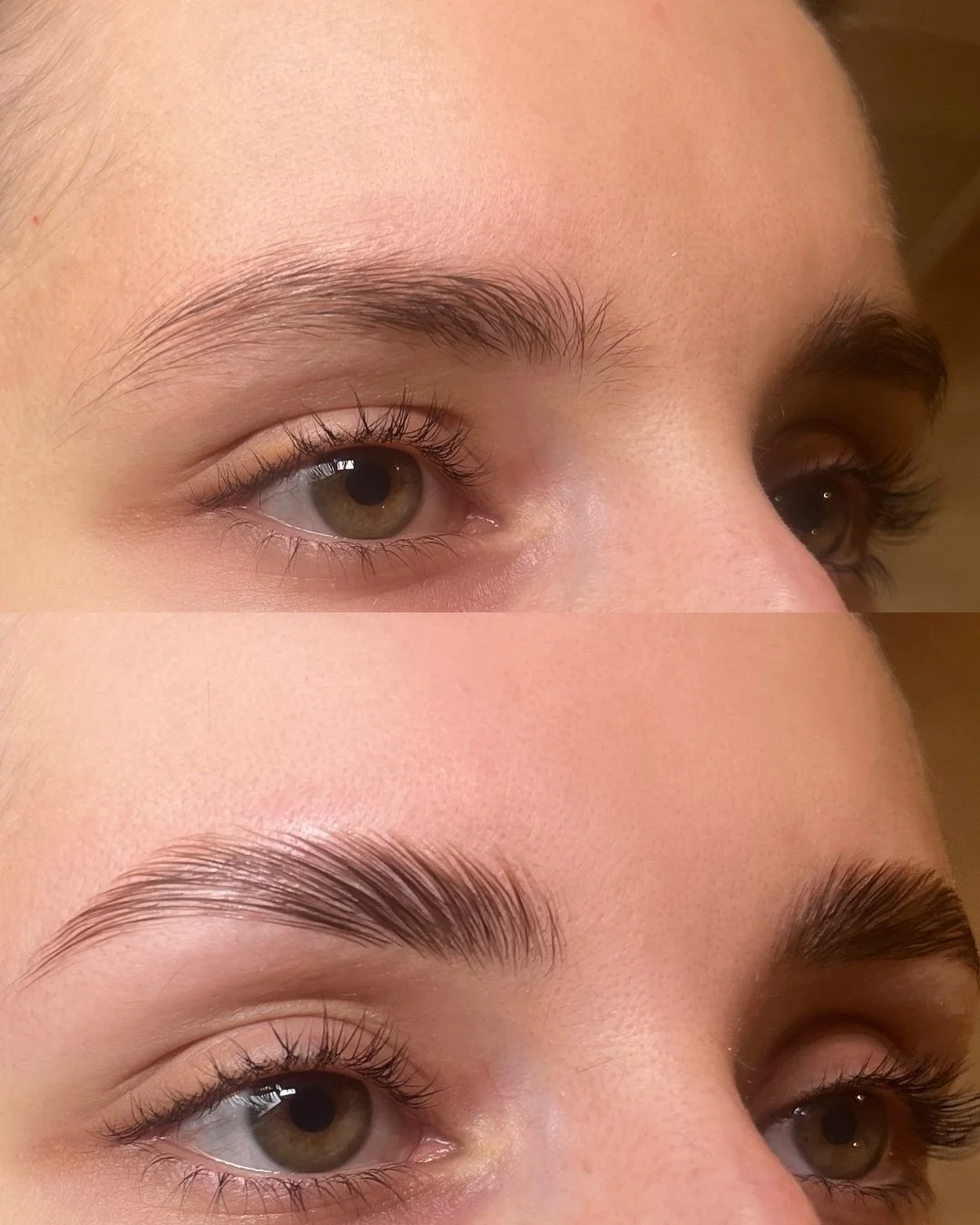 brows lift augenbrauen lifting korrektur