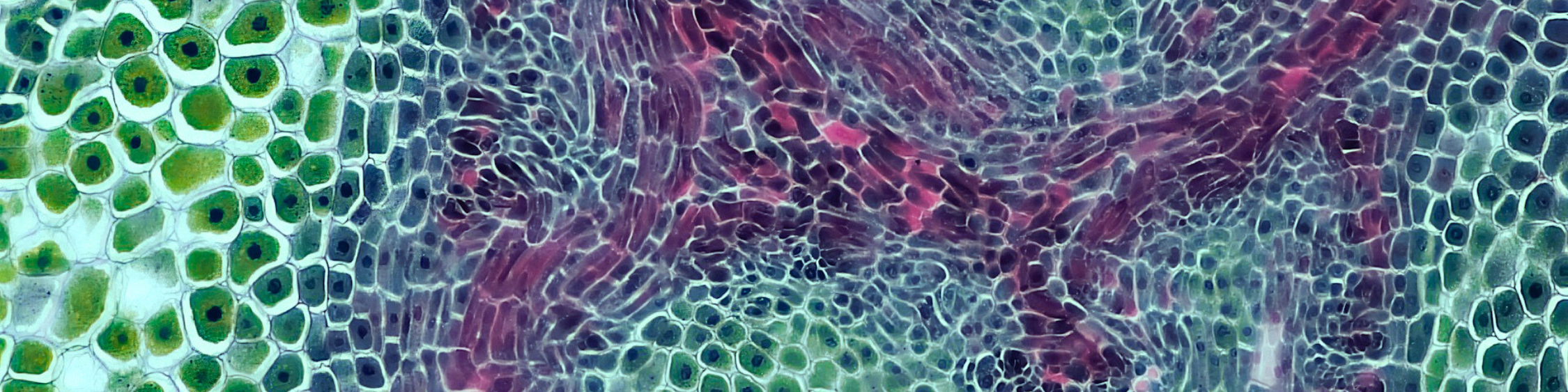 A close-up of the cross-section of a plant stem, showing green and purple vascular tissues and cell structures.