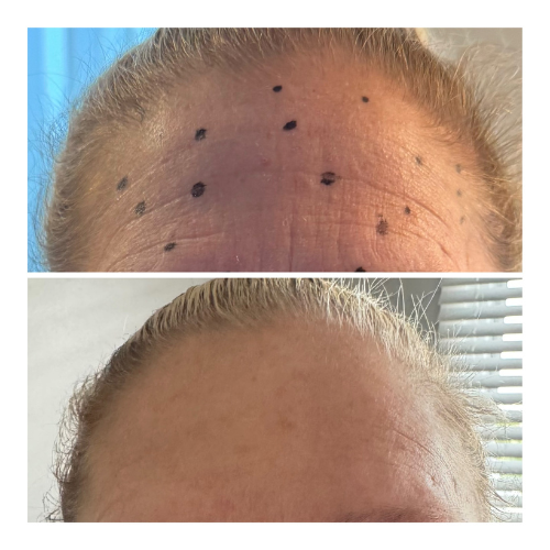 Smooth Line Aesthetics by Bonnie  Medspa in Mayfield, OH, 44124  Botox, Weight Loss, Peptides (9).png