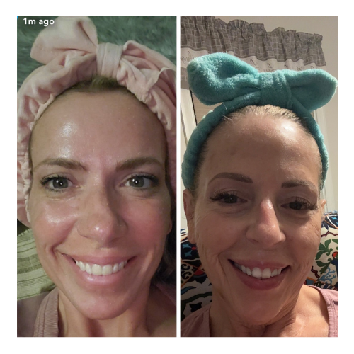 Smooth Line Aesthetics by Bonnie  Medspa in Mayfield, OH, 44124  Botox, Weight Loss, Peptides (10).png