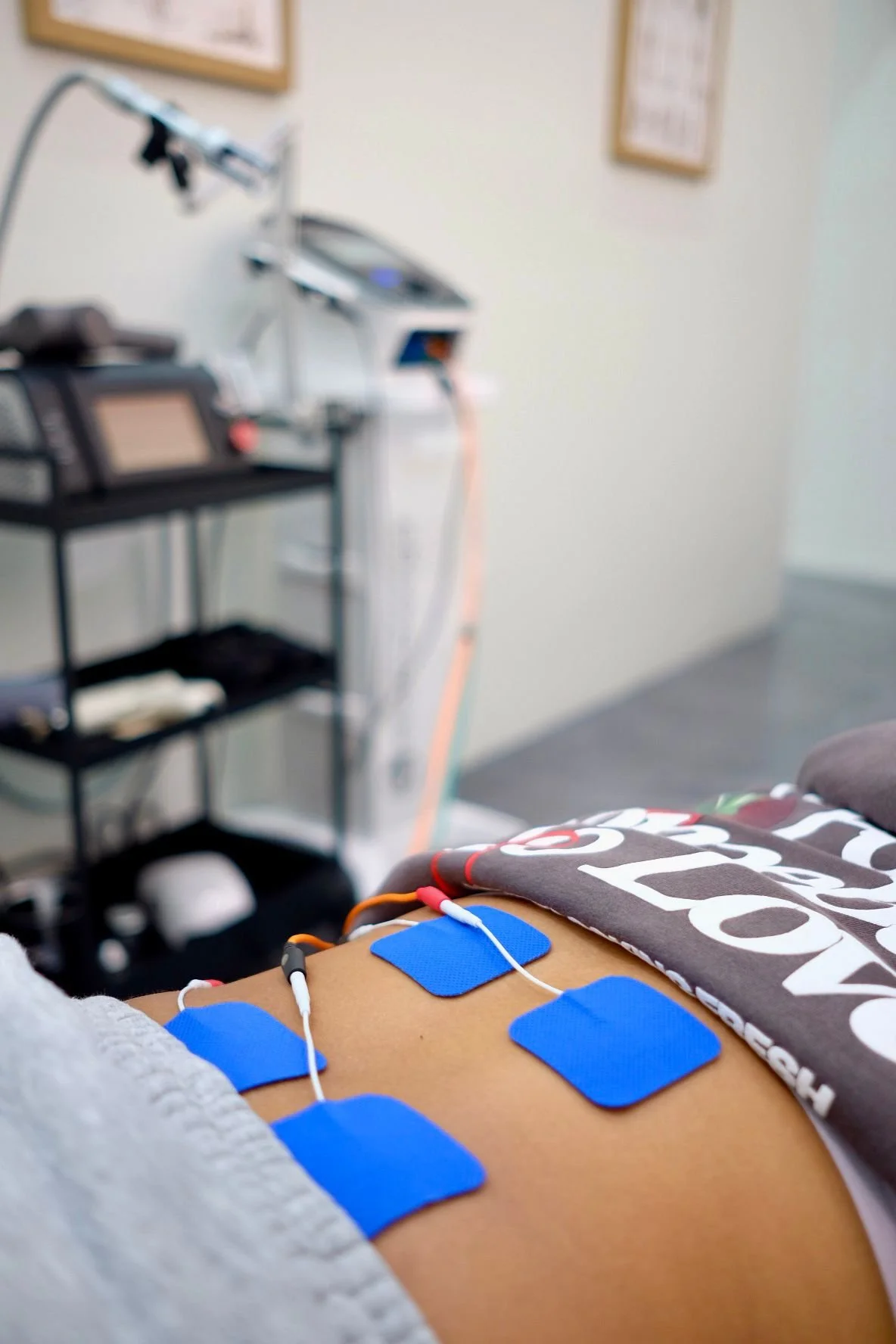 Estimulación Eléctrica (e-stim)