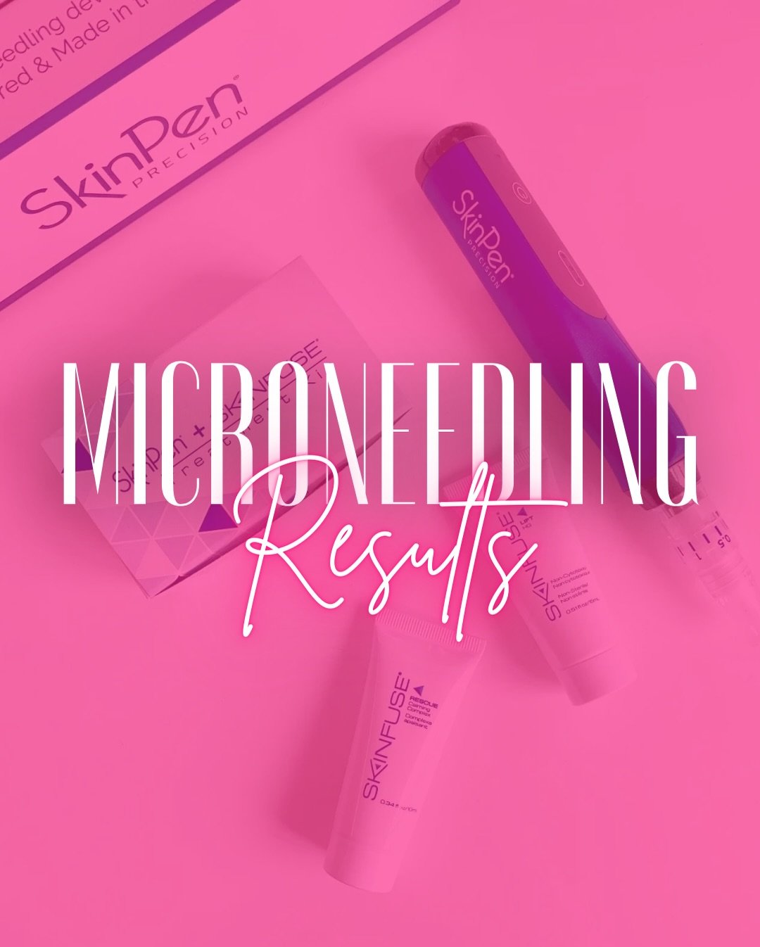 ✨ Microneedling with PRP &mdash; Before &amp; After Results ✨

This powerhouse treatment combines collagen-stimulating microneedling with PRP (your body&rsquo;s own growth factors) to visibly improve:
✔️ Skin texture &amp; tone
✔️ Fine lines &amp; ac