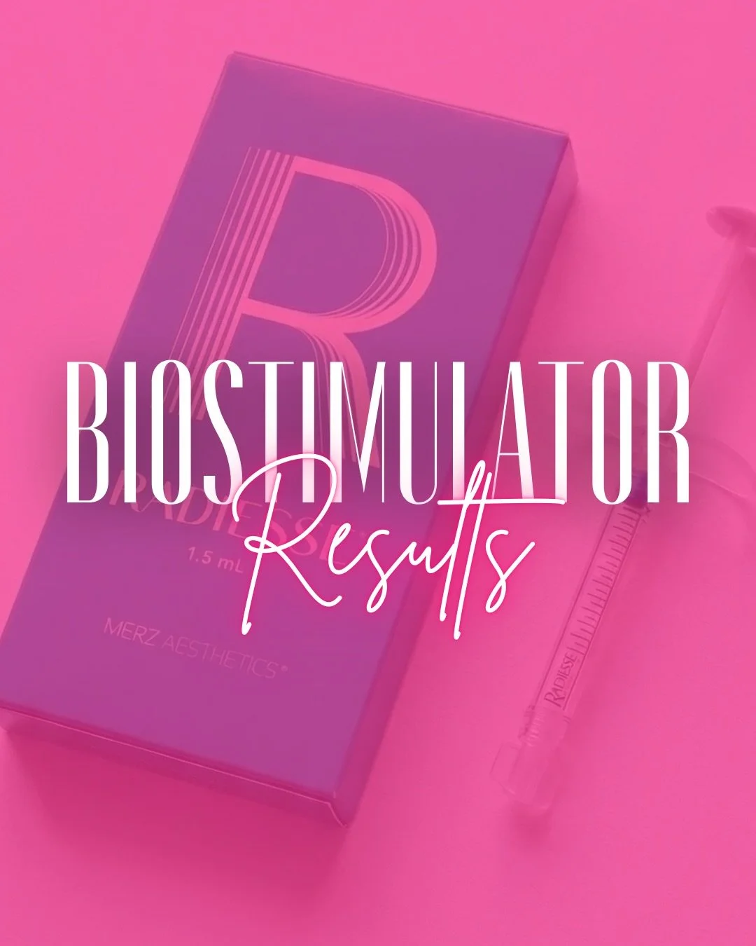 Take a look at this Radiesse transformation.
Subtle structure. Natural-looking rejuvenation.

Radiesse is a collagen-stimulating filler that helps restore facial volume while encouraging your body to produce its own collagen over time, creating smoot