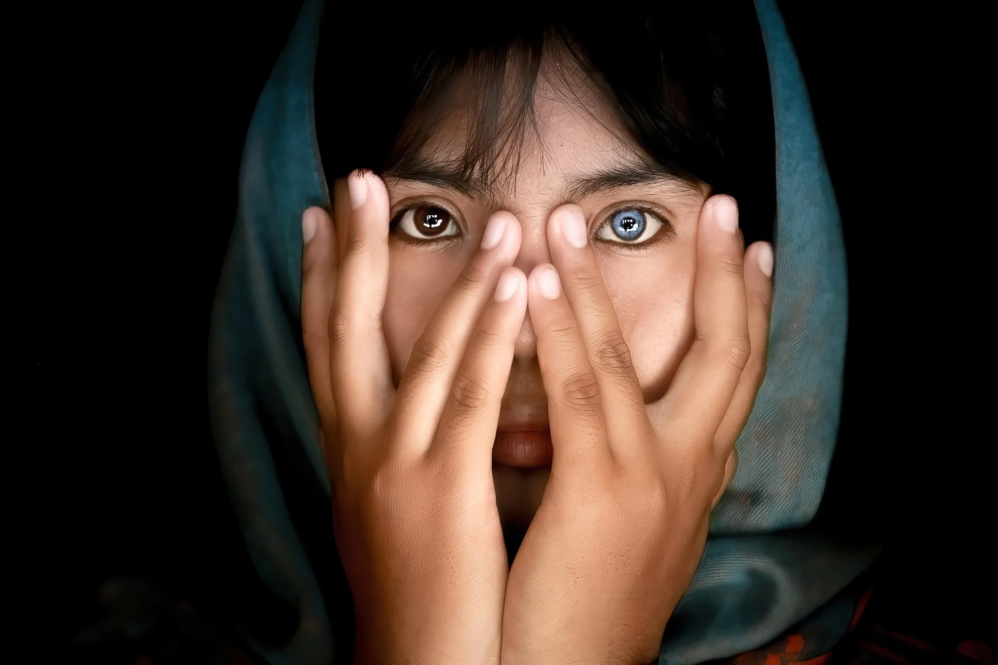 A woman with heterochromatic eyes, one brown and one blue, holds her face with both hands, partially covering her cheeks and nose, with a dark background.