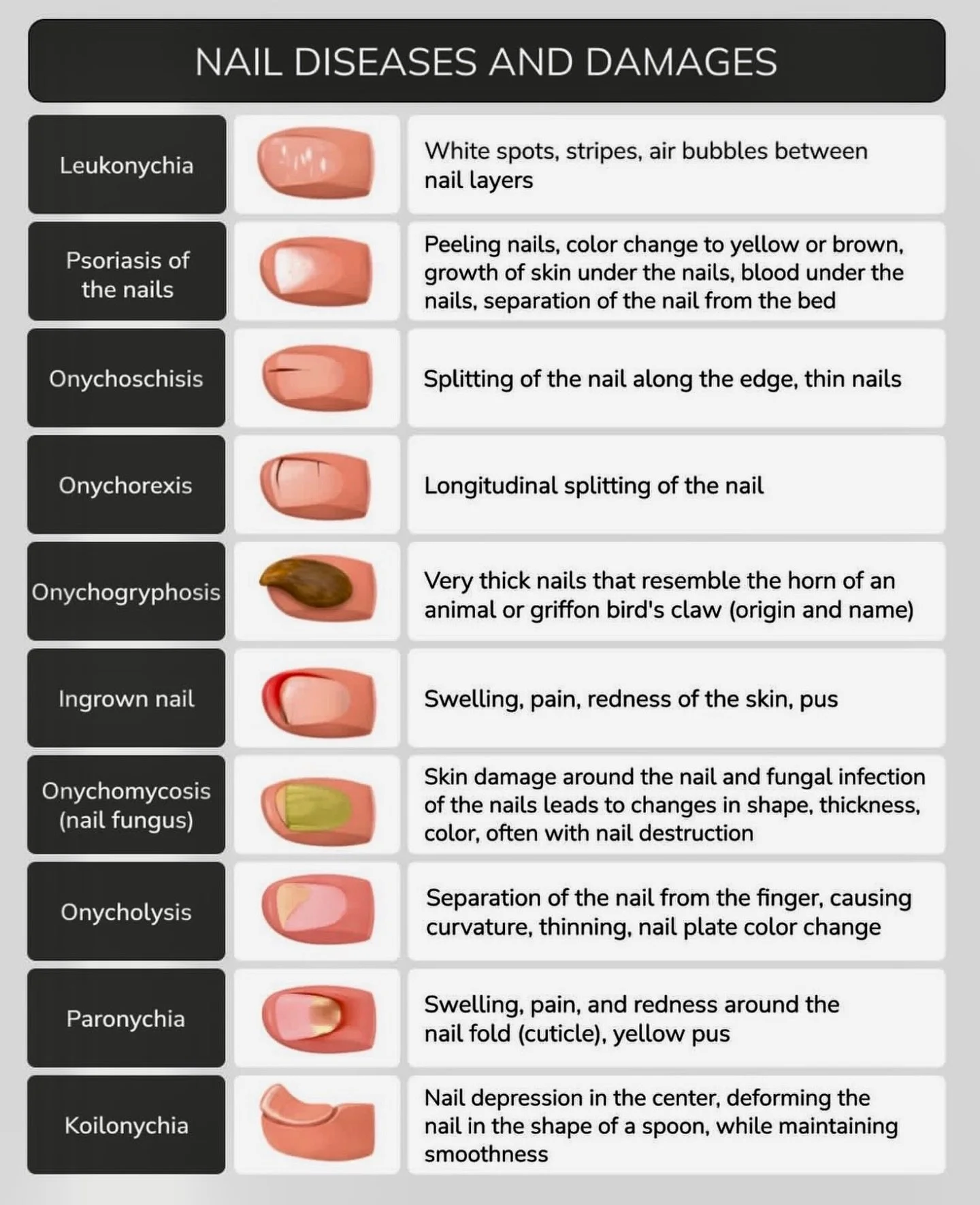 Protect your nails health. #nailshealth #luxurynails  #nyahnailboutique