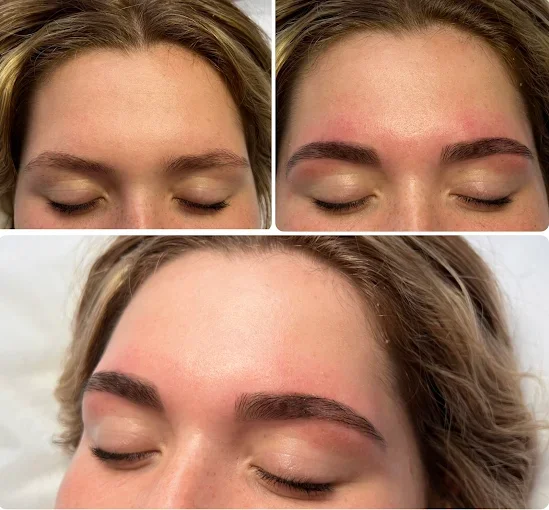 A three-panel image showing a woman's eyebrows before, during, and after an eyebrow treatment, with the eyebrows appearing fuller and more defined in the after photo.