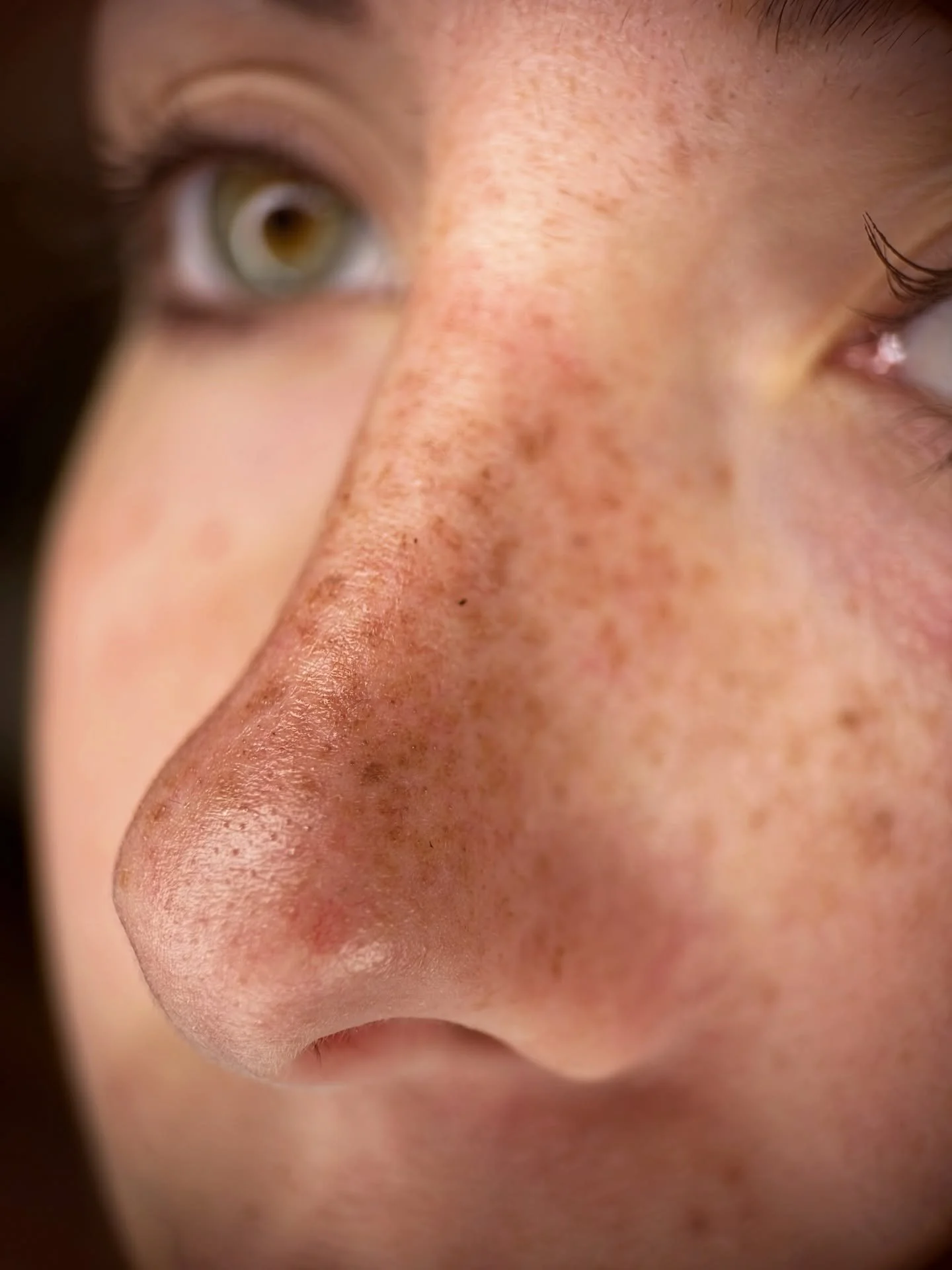 Le mie Lentiggini Tatuate 🍓
Avete mai visto niente di pi&ugrave; naturale? 

Un buon trattamento di lentiggini tatuate si contraddistingue per naturalezza e personalizzazione su ogni volto, il risultato in guarigione &eacute; fresco, giovanile e le 