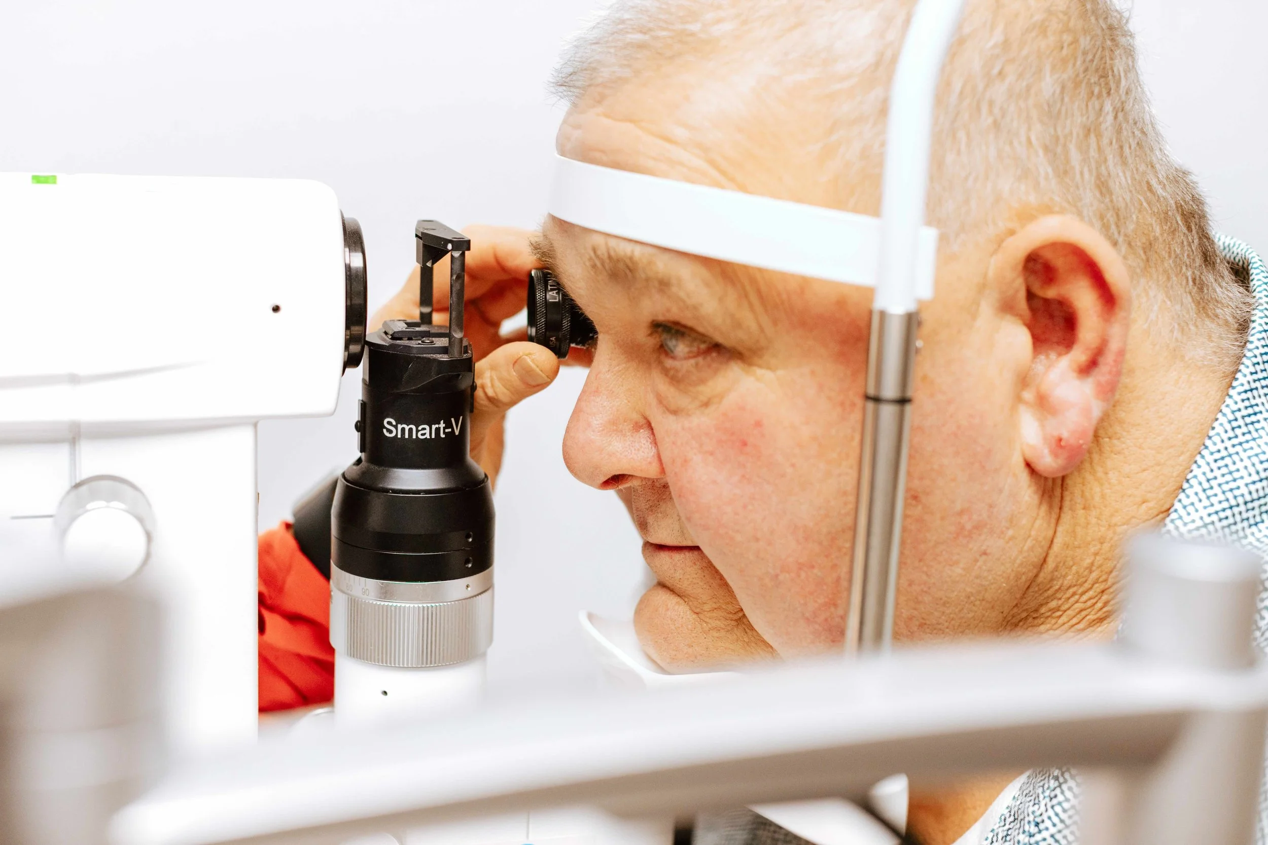 Senior man with bald head and light skin looks into a microscope during his Selective Laser Trabeculoplasty (SLT) procedure.