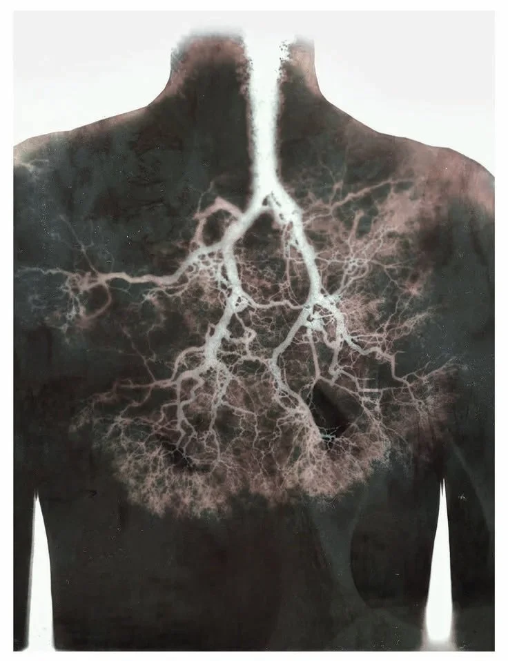 A medical illustration of human lungs and heart with a network of blood vessels overlayed in white.