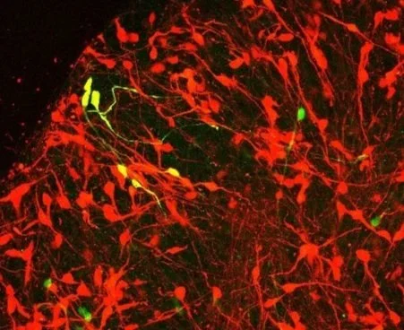 Microscopic view of neurons with red nerve fibers and green cell bodies.
