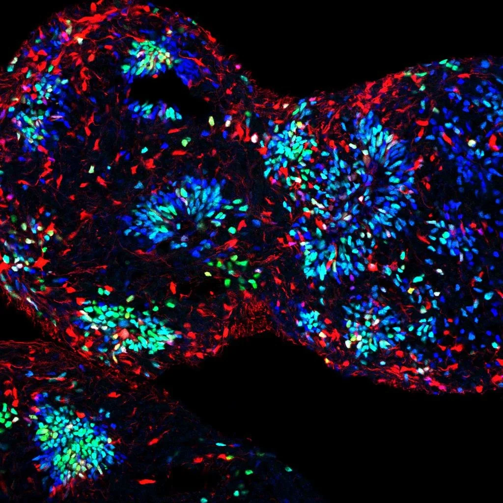 Fluorescently stained tissue sample with blue, green, and red colors highlighting cellular structures under a microscope.