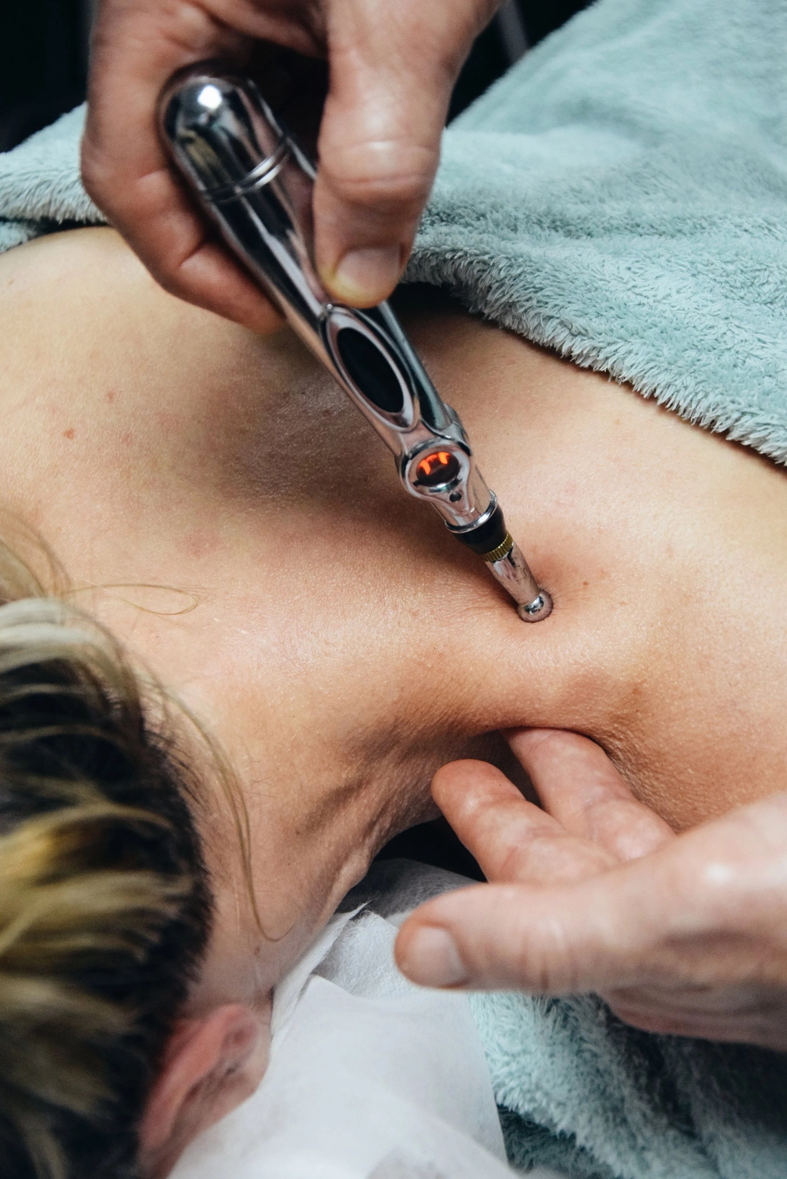 A person receiving a cosmetic or medical procedure involving a small device inserted into their navel area while lying down, with a towel partially covering them.