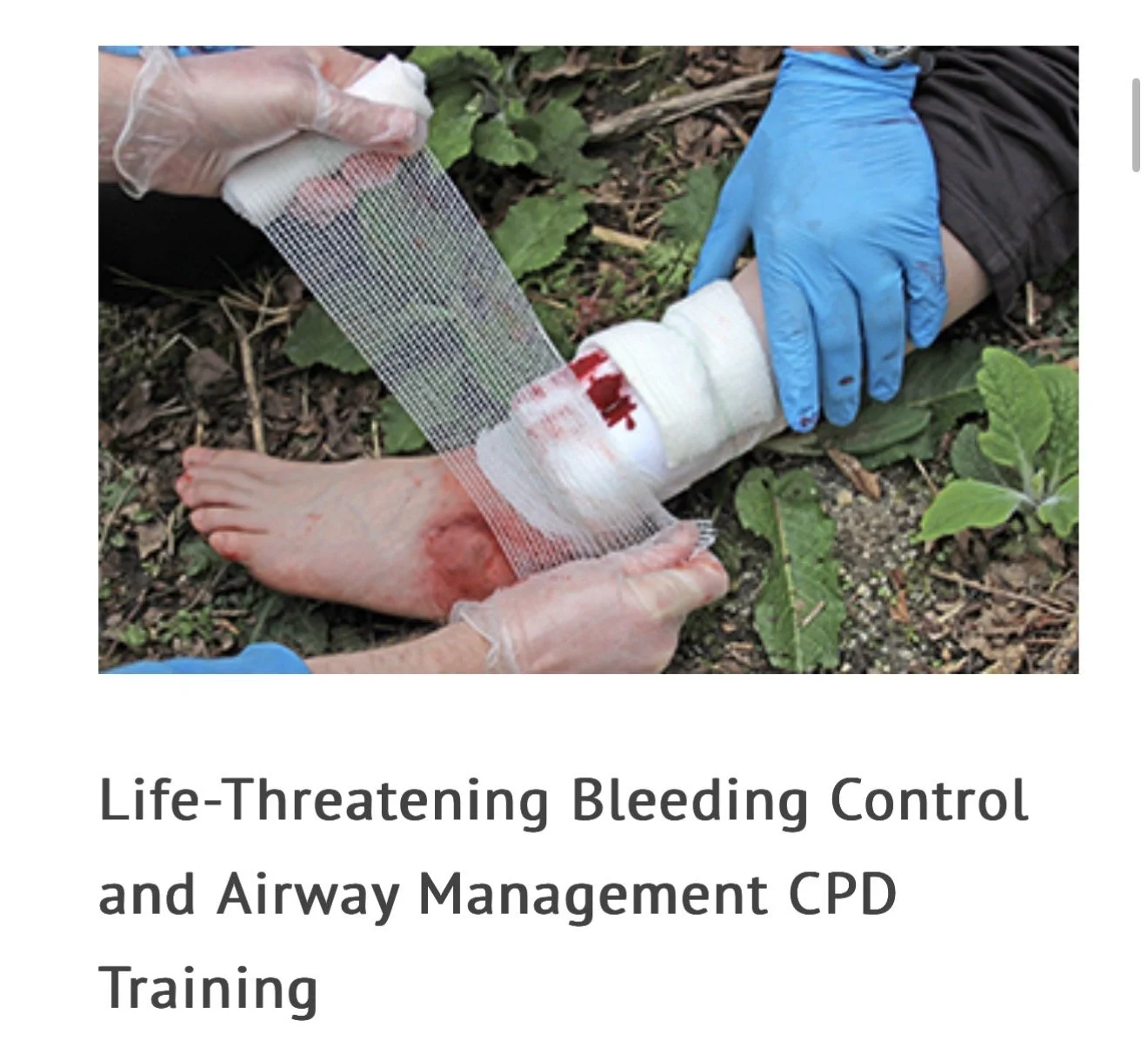 Life Threatening Bleed Control