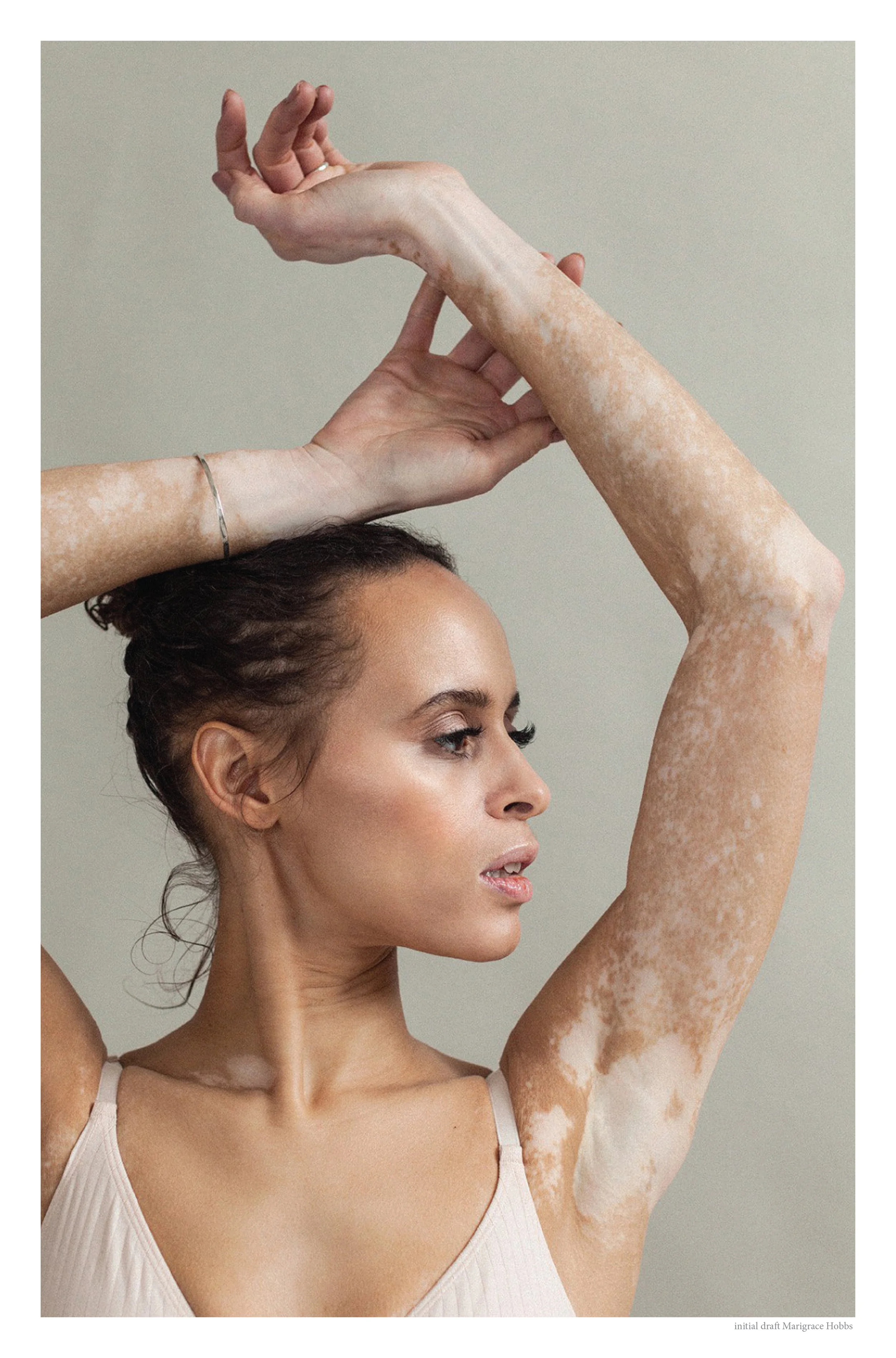 SKIN MG HOBBS-11.jpg