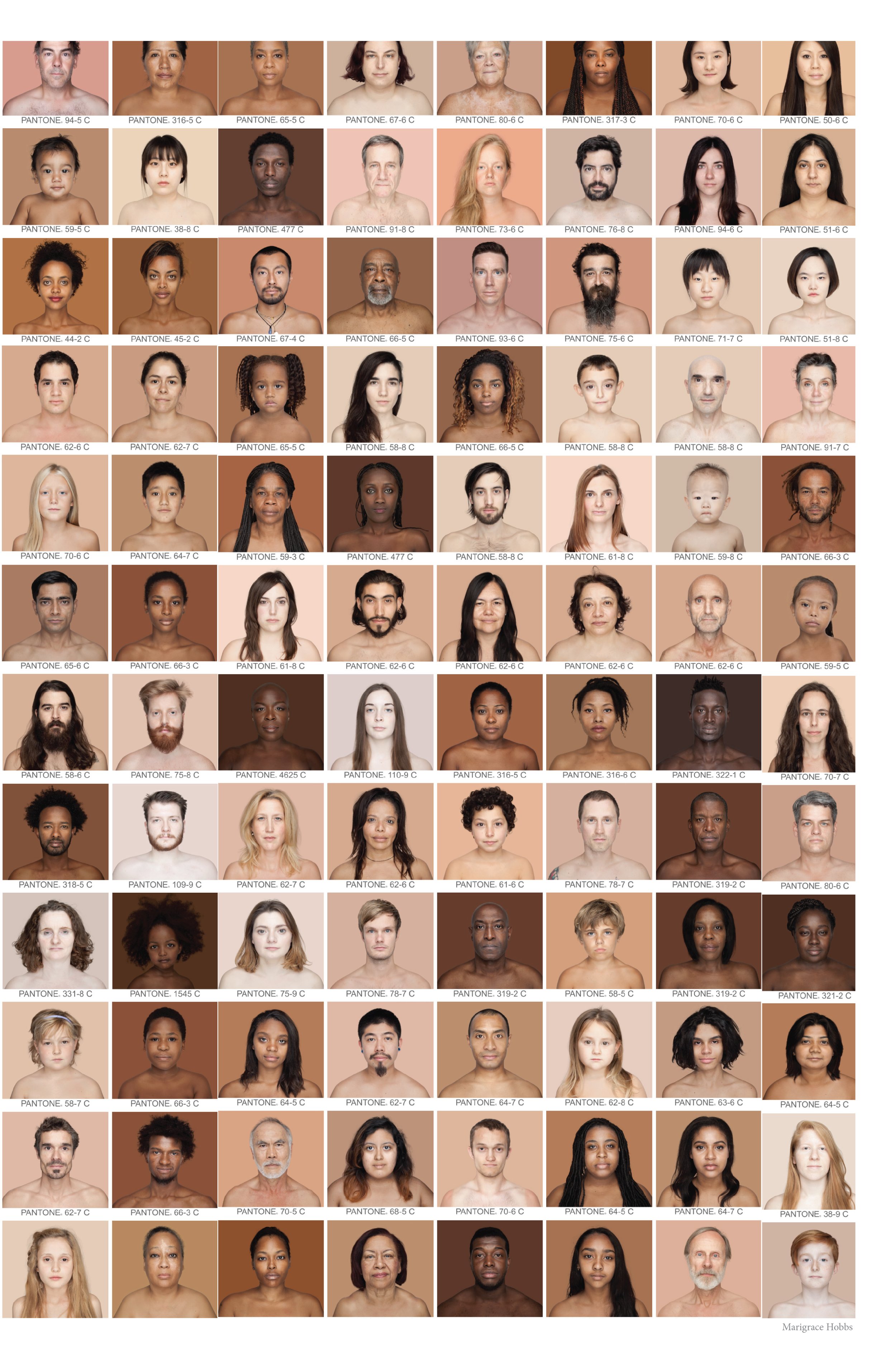 SKIN MG HOBBS-17.jpg