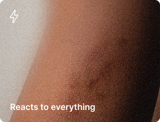 Close-up of skin with a small scar or blemish and a caption that reads 'Reacts to everything'.