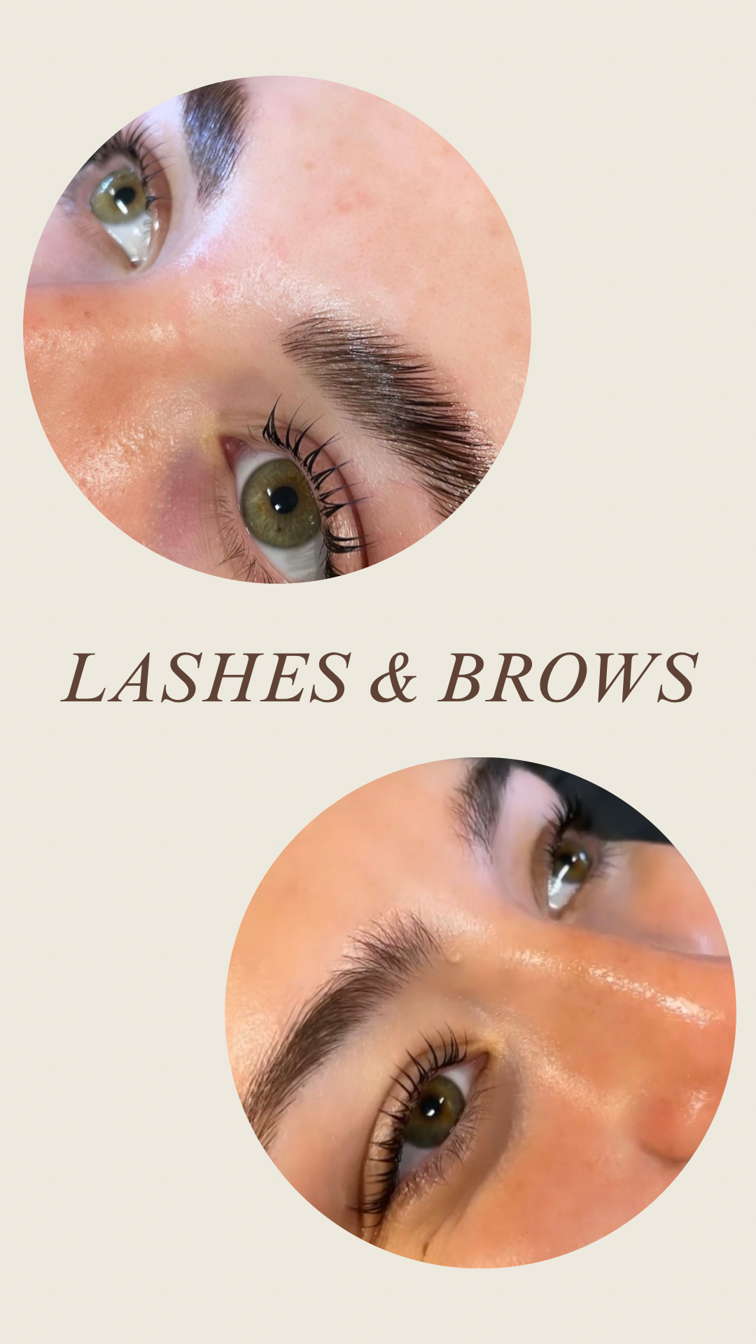 Chemical Peel - 3.PNG